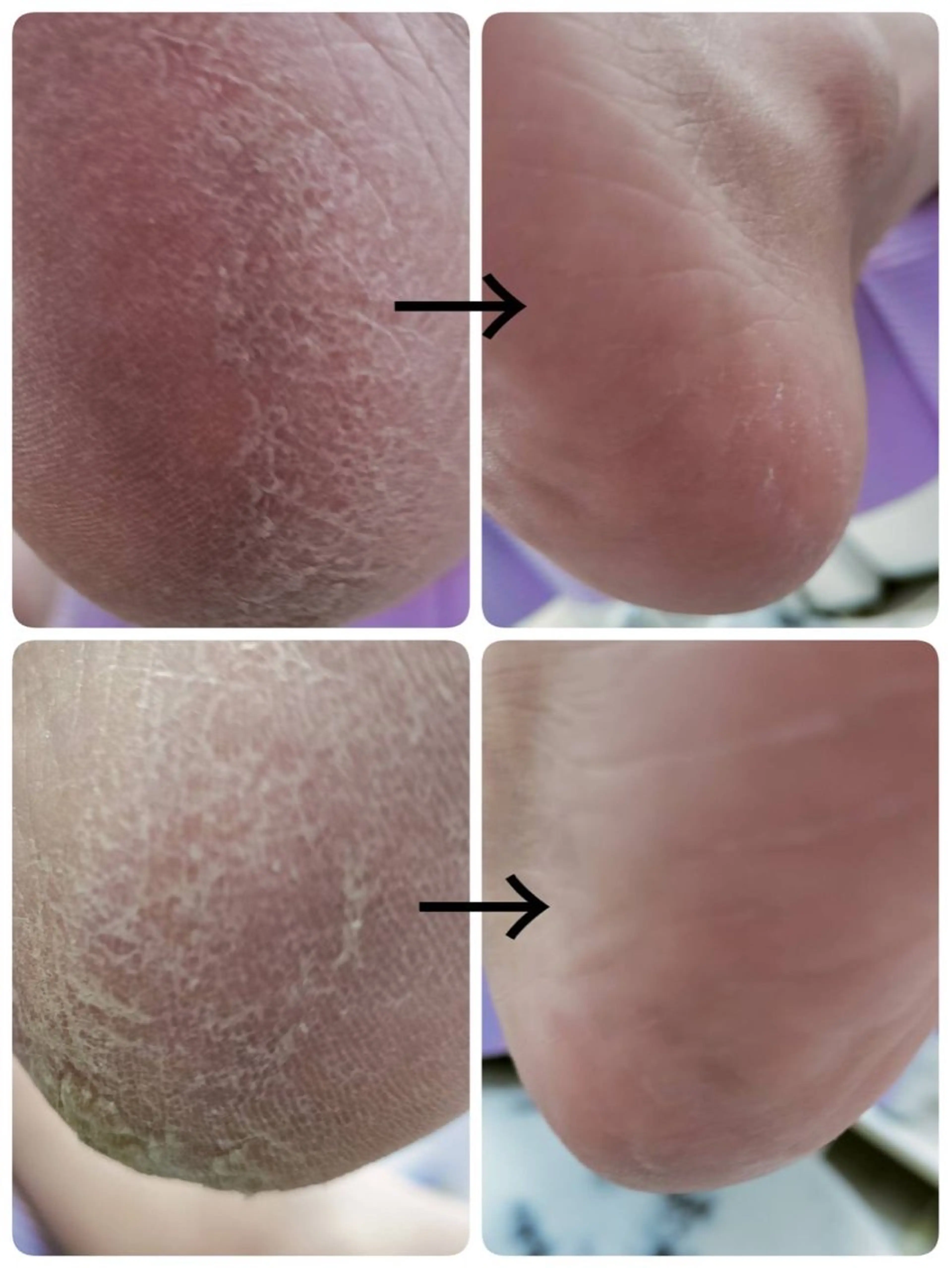 ネイル その他(ネイル) e.nail所属・和賀井 恵理のネイルデザイン