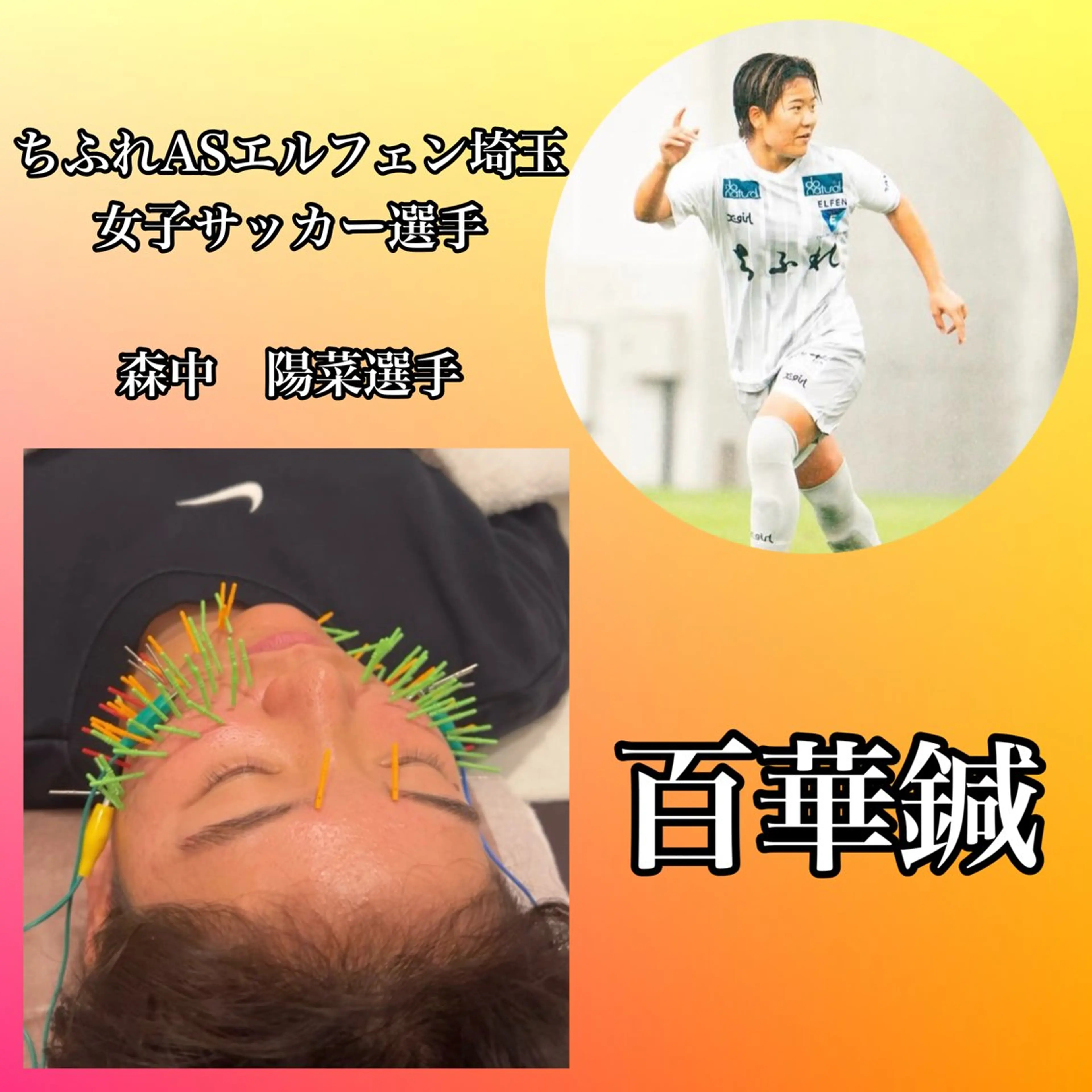 エステ リラク 肌質改善×美容鍼 ゆいのエステ・リラクイメージ