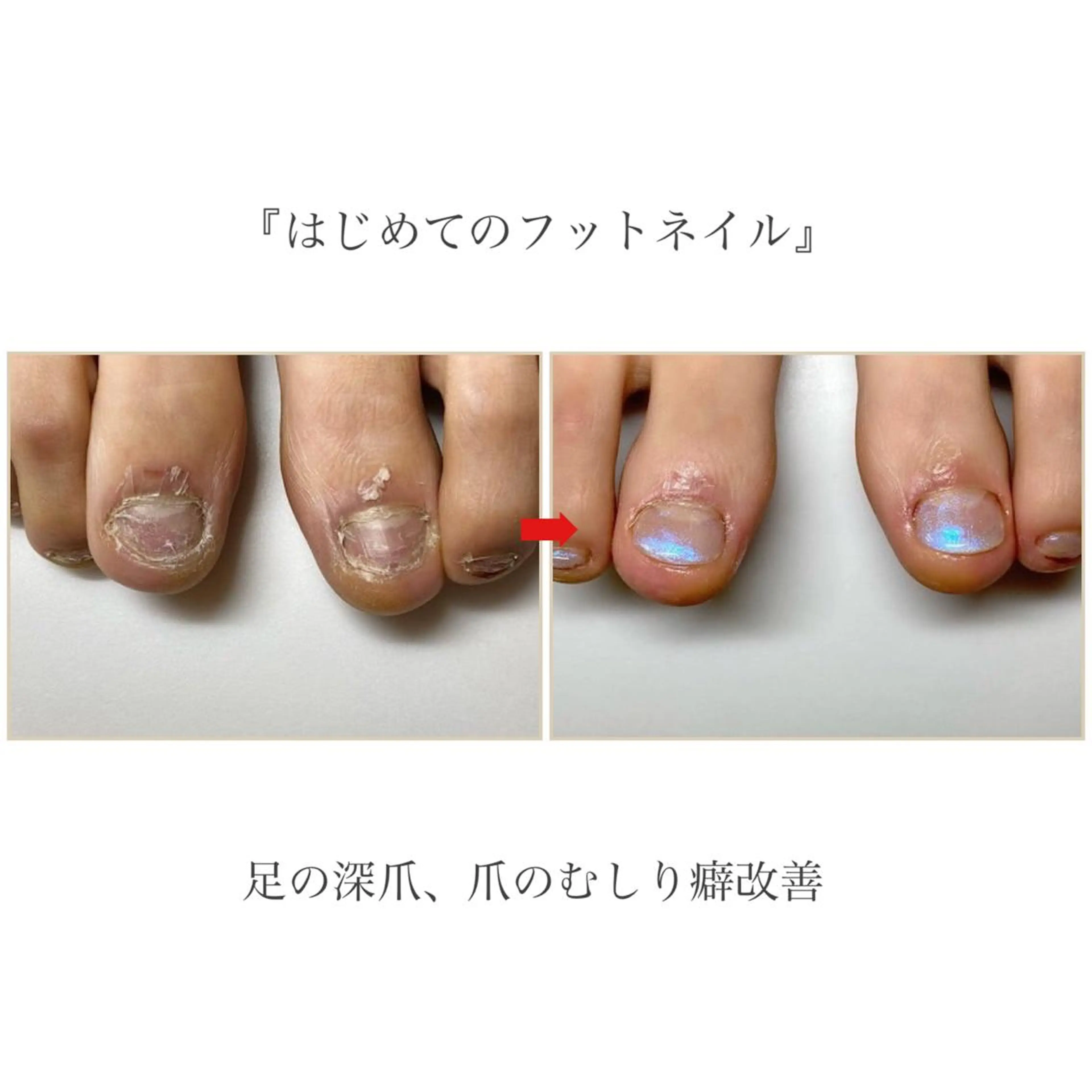 ネイル フットネイル ネイルサロン アリュームのネイルデザイン