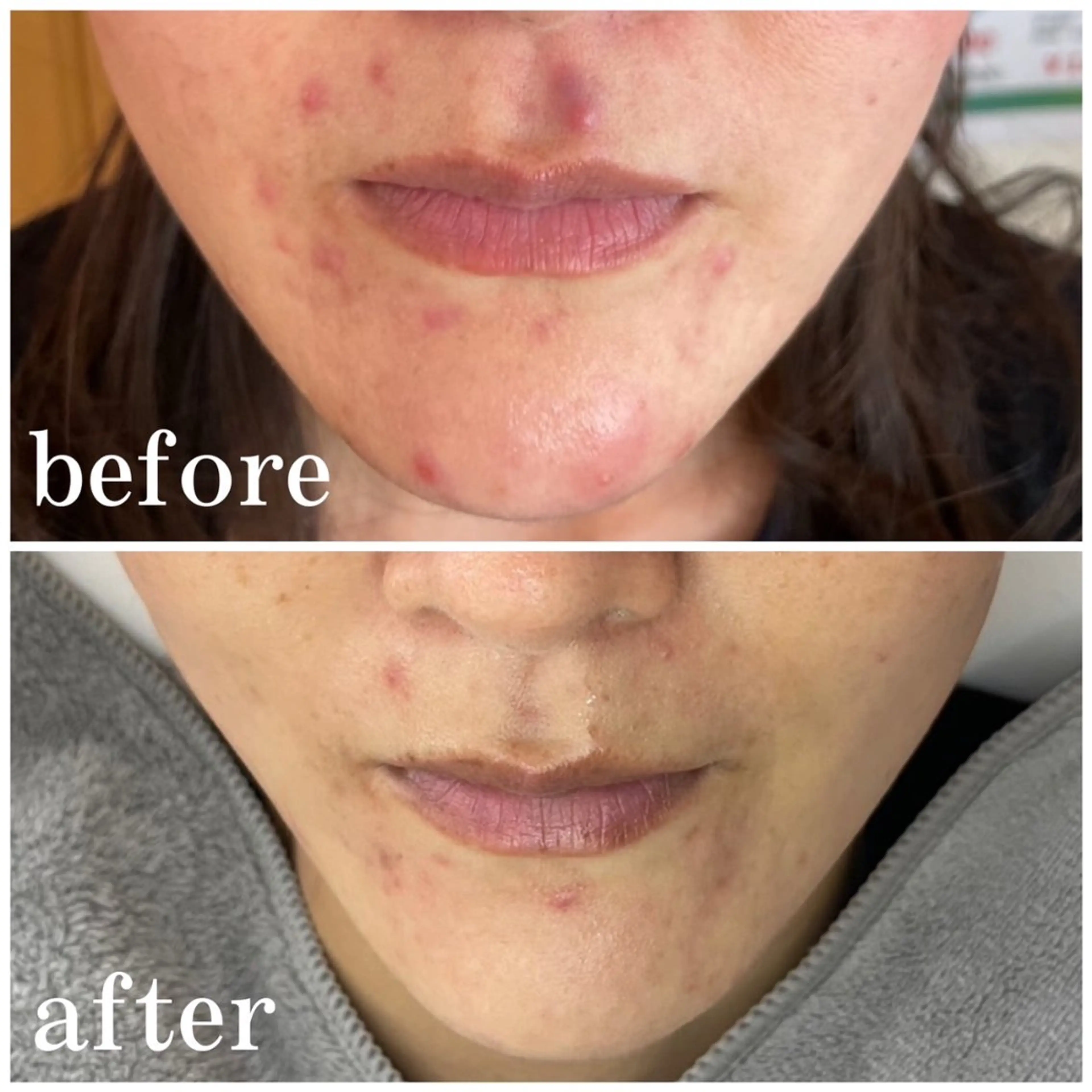 サロンピュア 所沢店のエステ・リラクイメージ