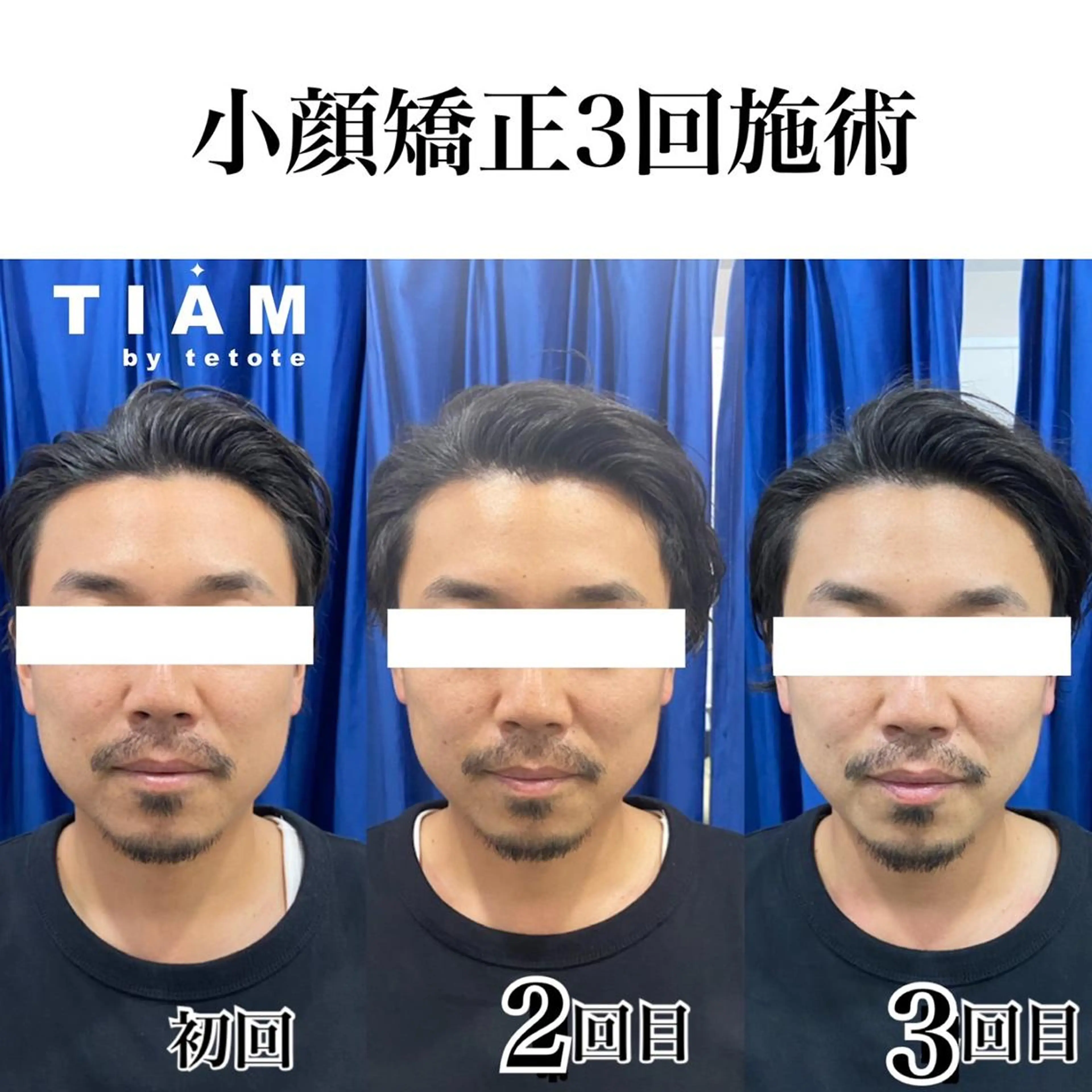 美肌サロンTIAM by tetoteのエステ・リラクイメージ