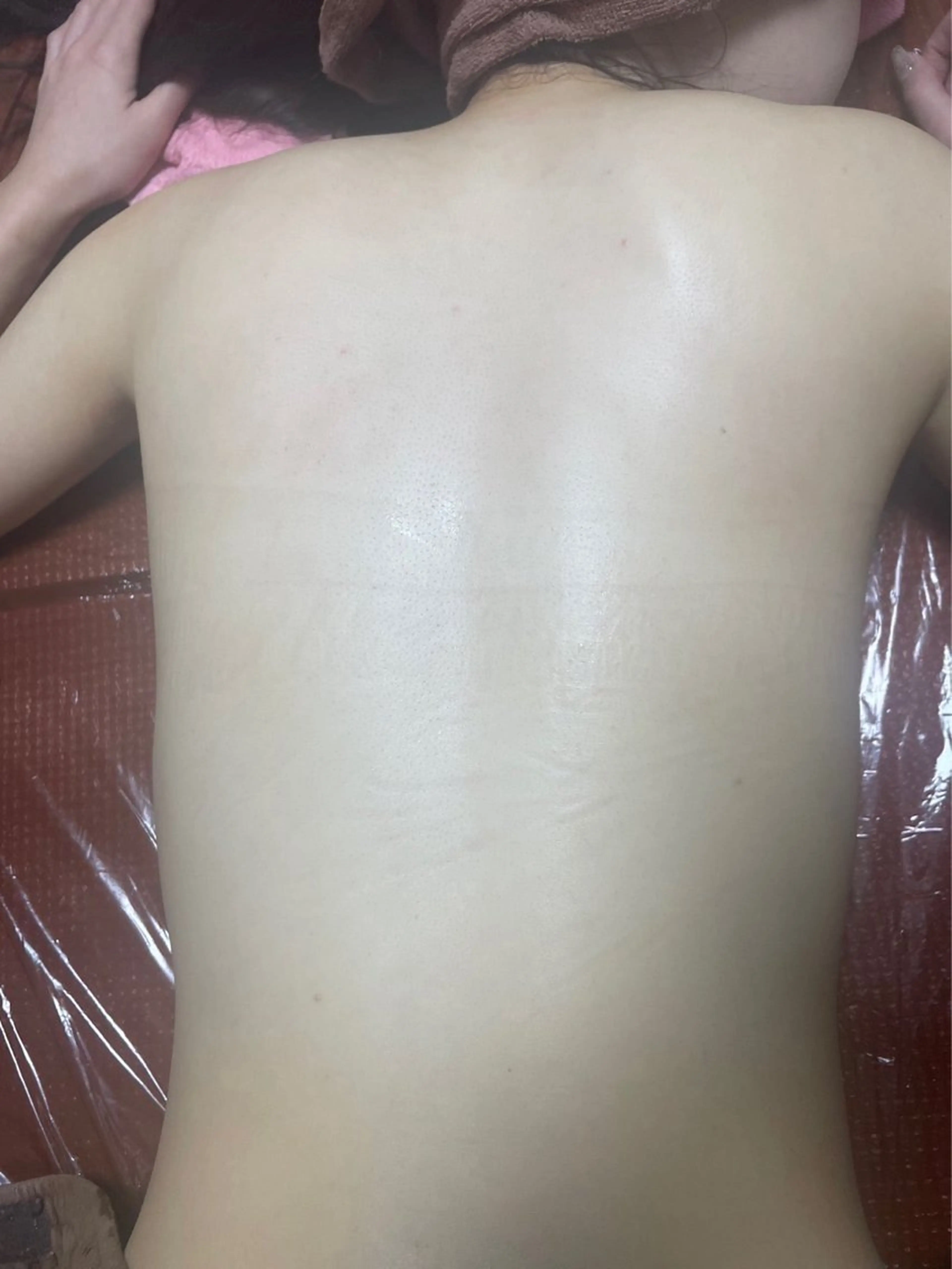 【背中丸ごと美肌💎】背中全面脱毛＋保湿ケア付♡隙のないツヤ肌へ✨の写真