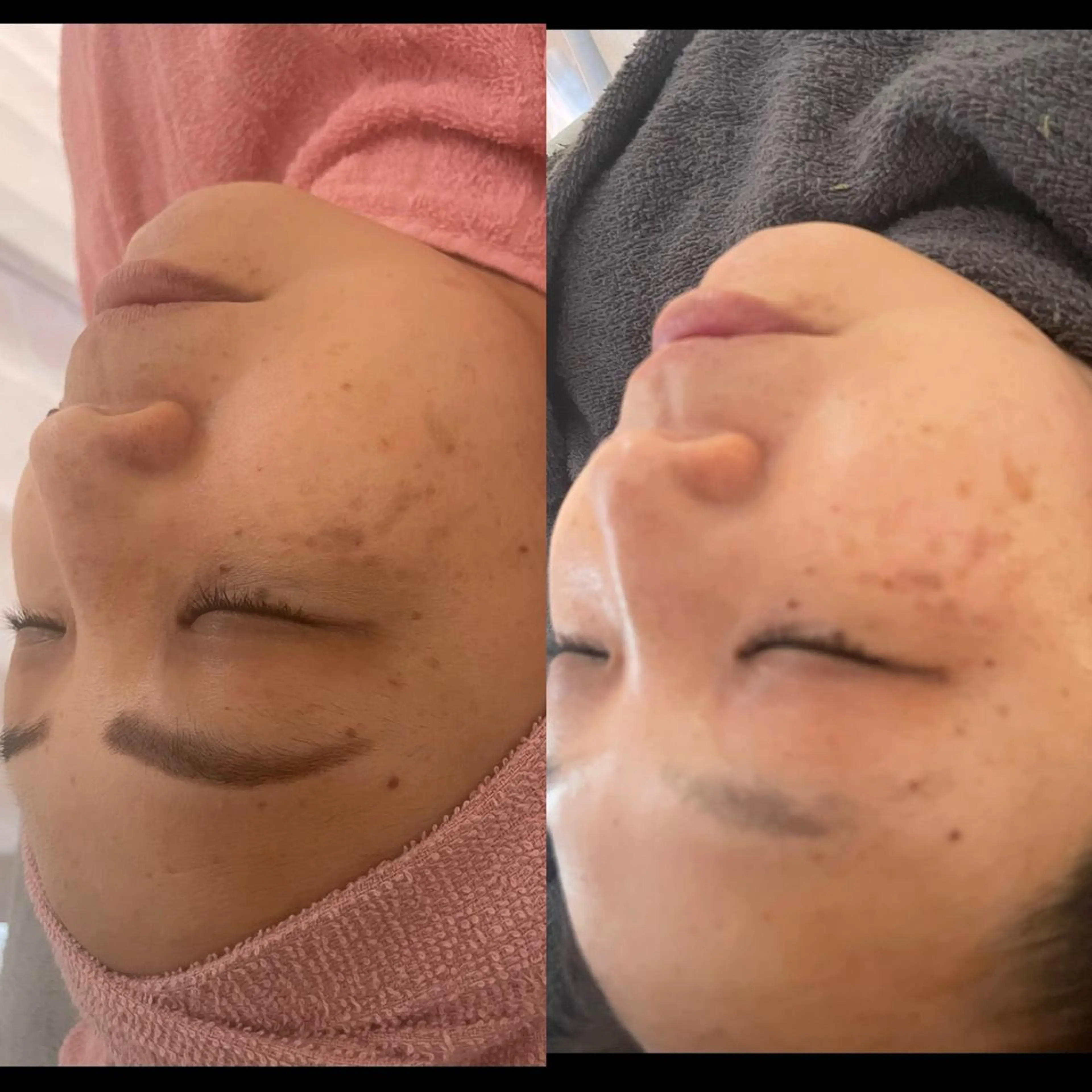 beauty lanaのエステ・リラクイメージ