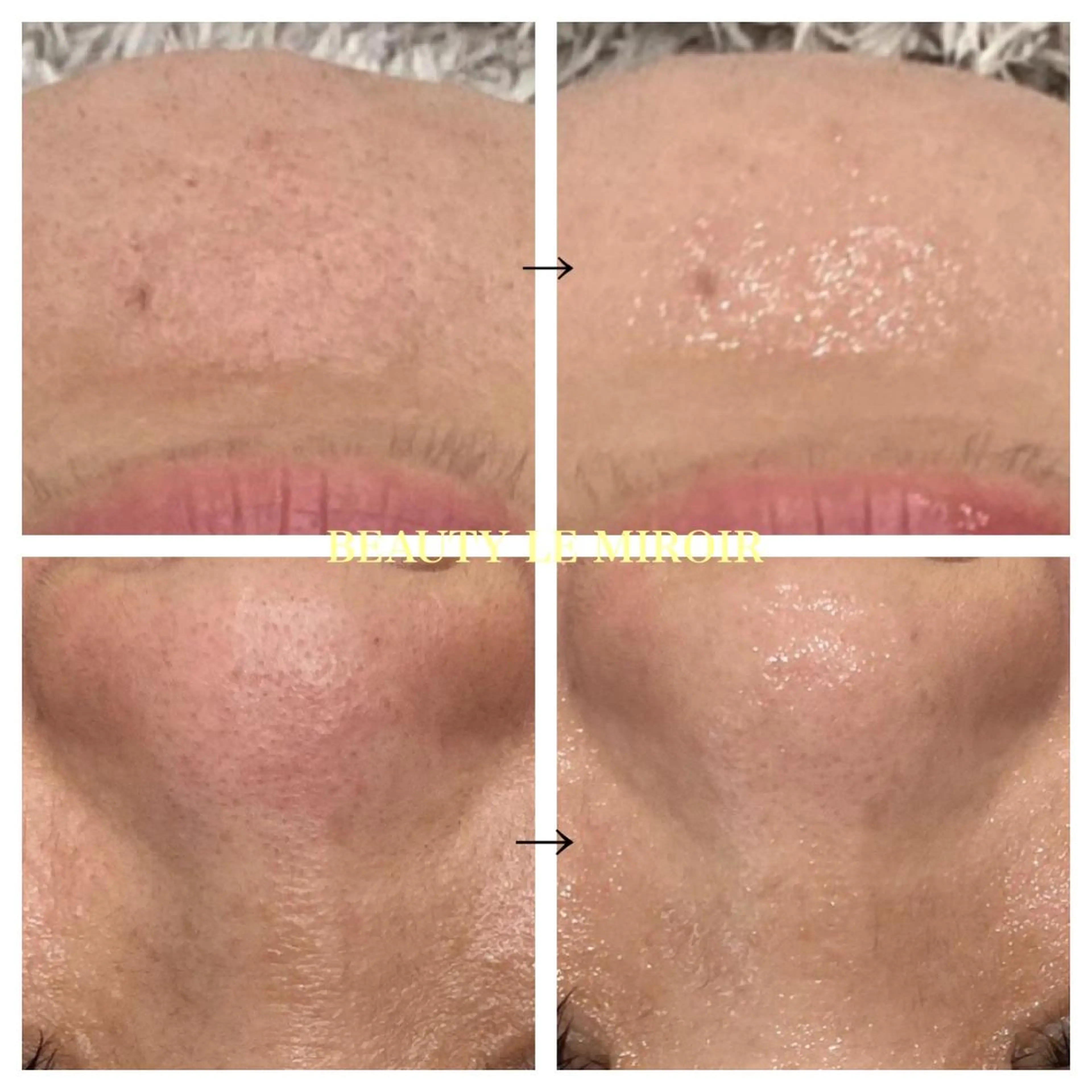 ビューティー ミロワールのエステ・リラクイメージ