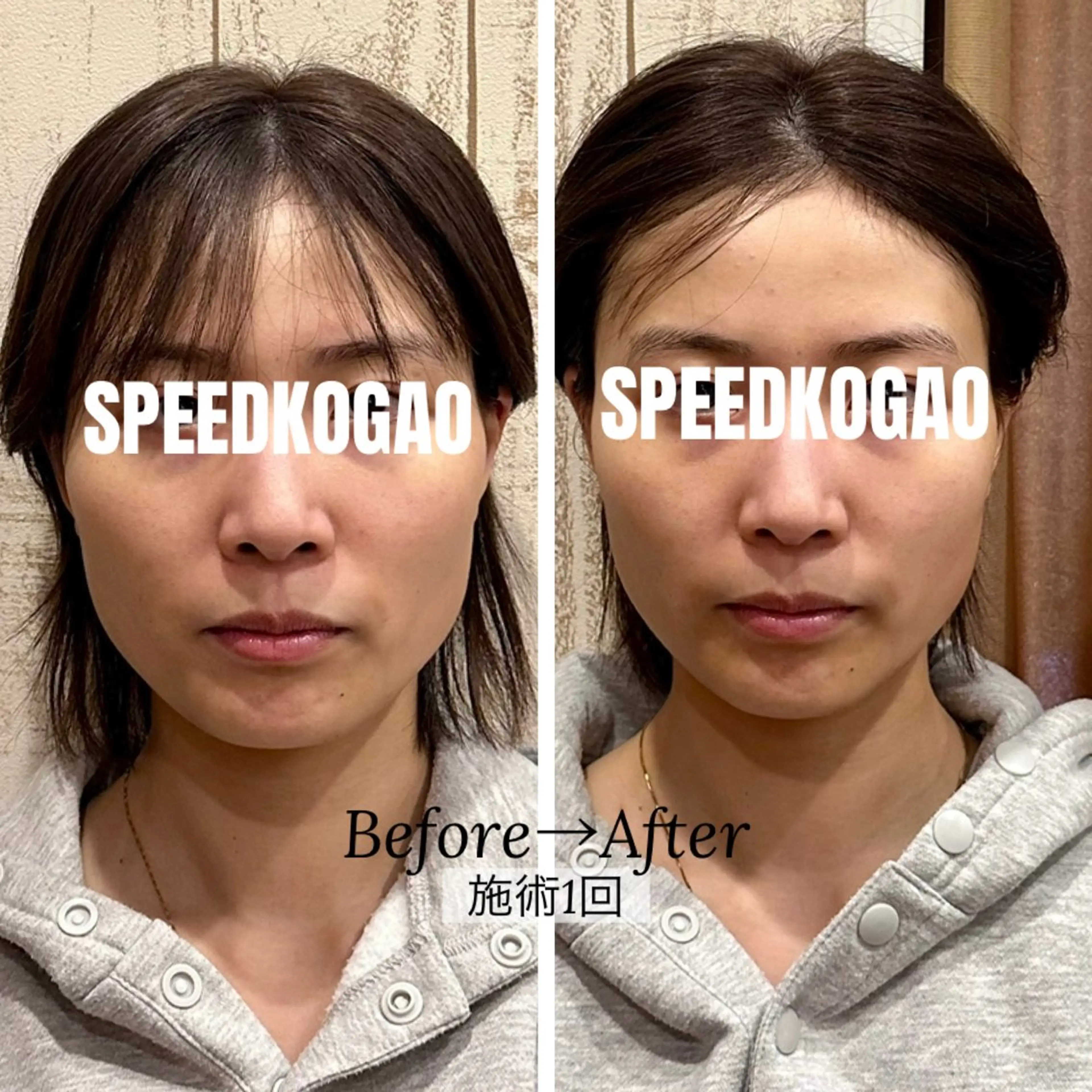 エステ リラク 小顔矯正Speed KOGAO渋谷本店のエステ・リラクイメージ