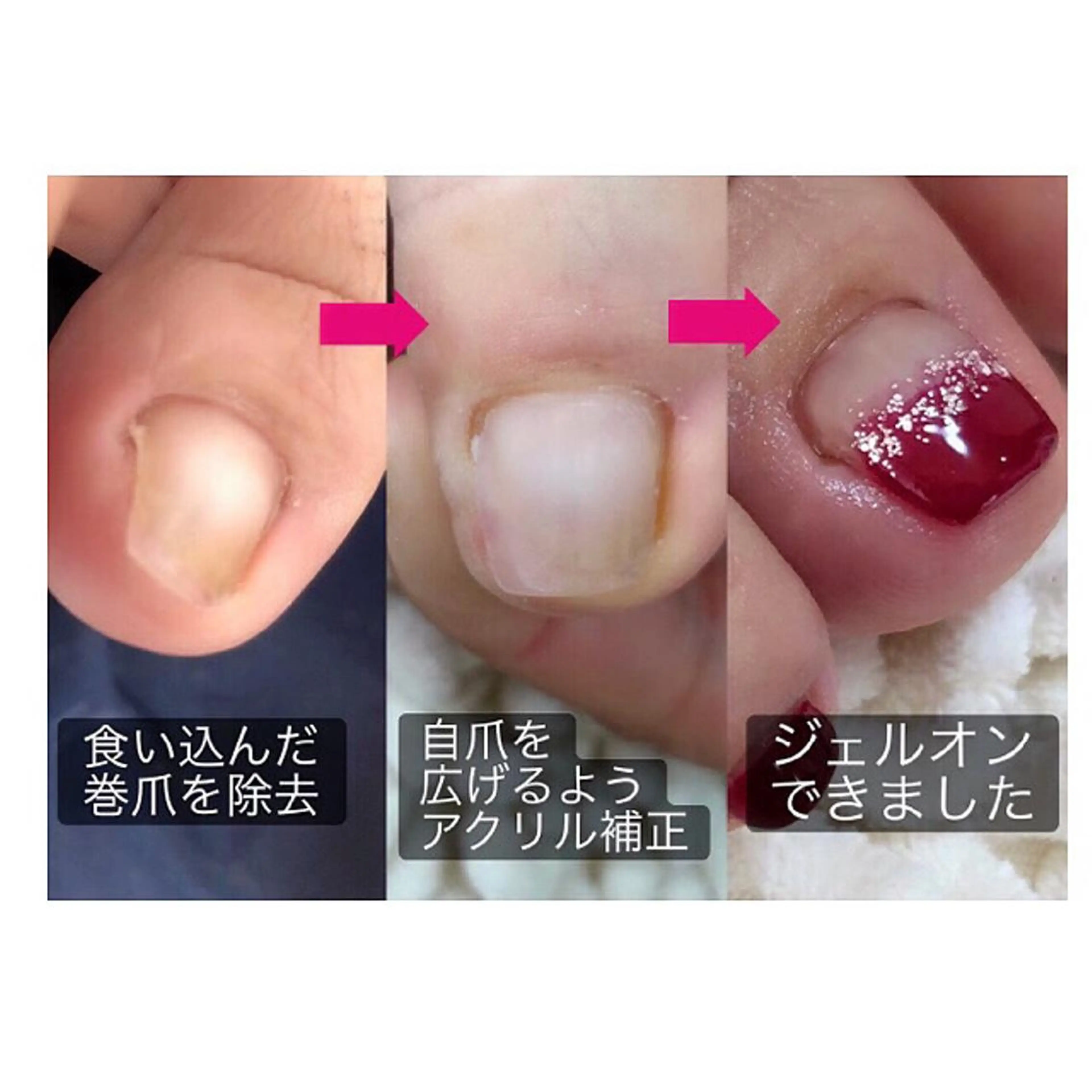 ネイル ジェルネイル その他 t. yoshizawaのネイルデザイン