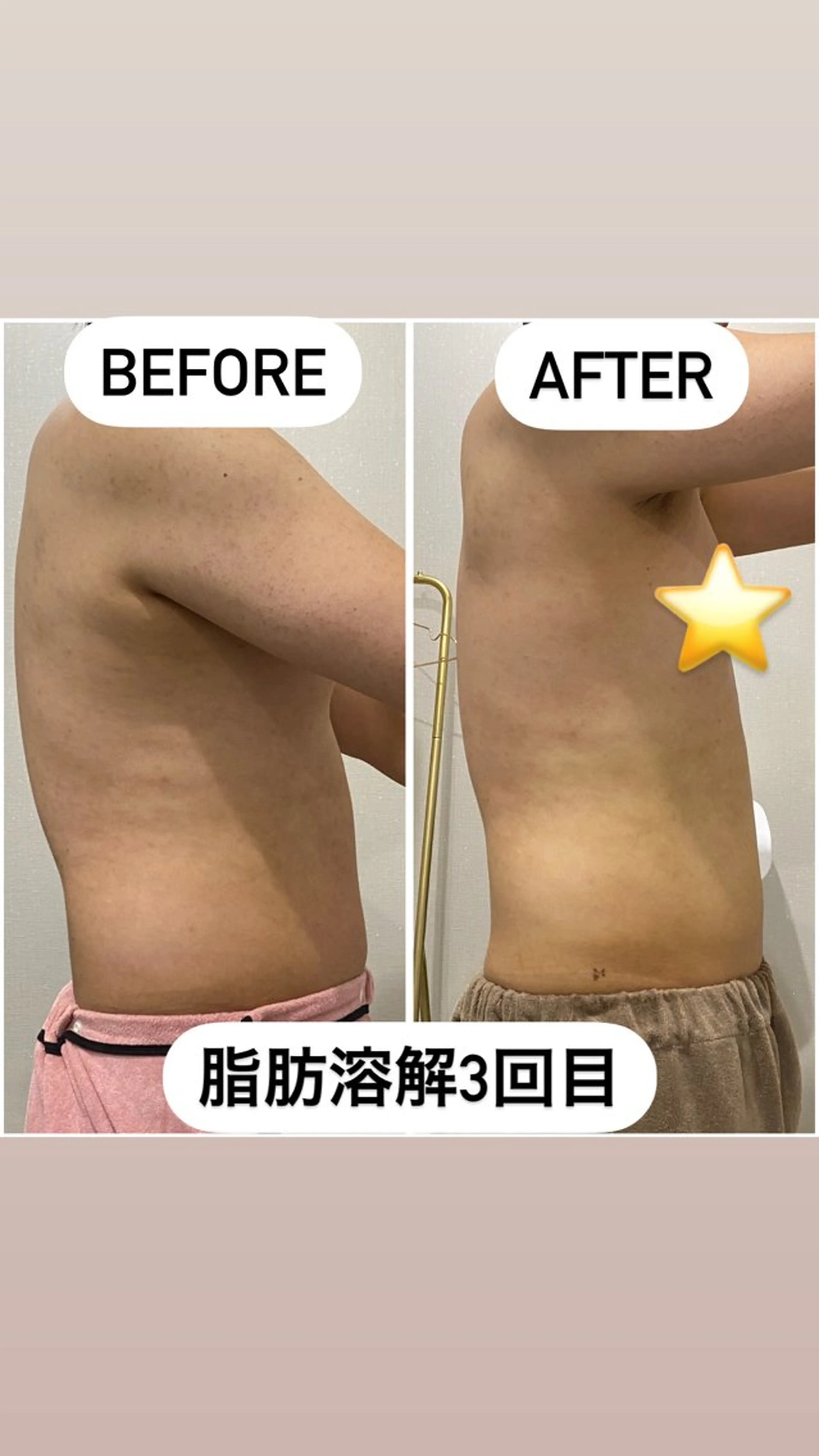 エステ アルカンジュ~archange~所属・痩身/毛穴洗浄/脱毛 アルカンジュのエステ・リラクイメージ