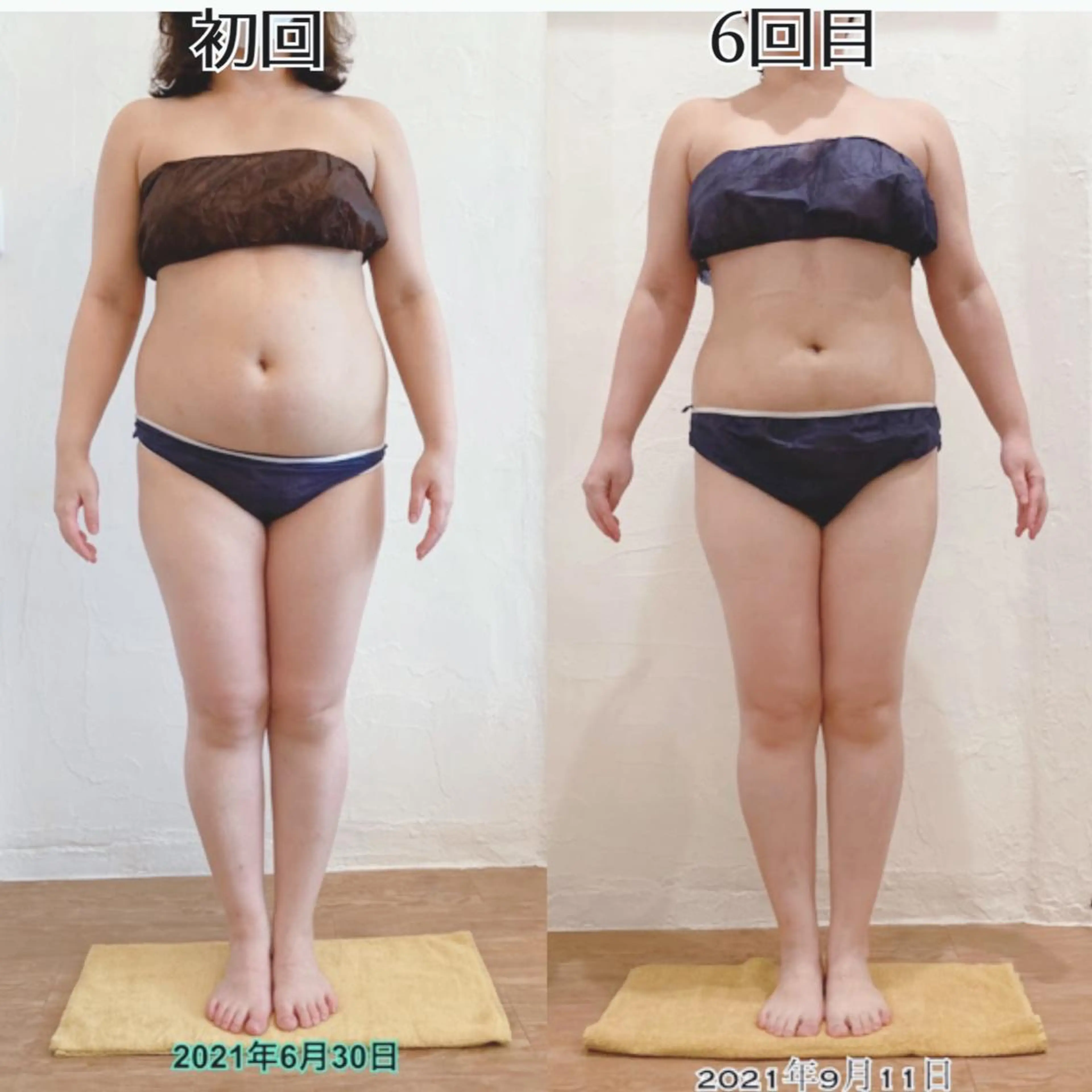 むくみ専門痩身 マクイエステティックのエステ・リラクイメージ