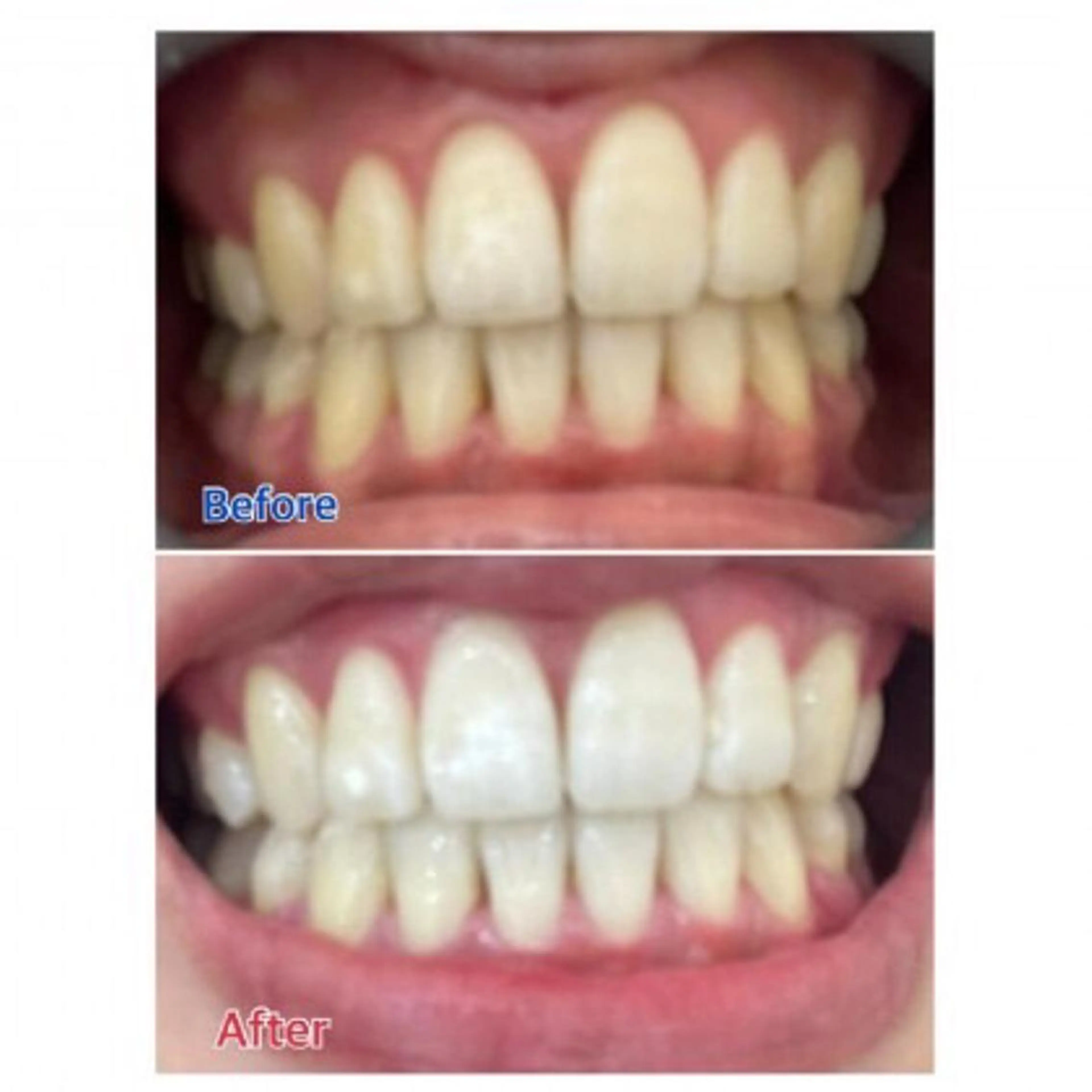 Ｍ渋谷 ホワイトニングのエステ・リラクイメージ