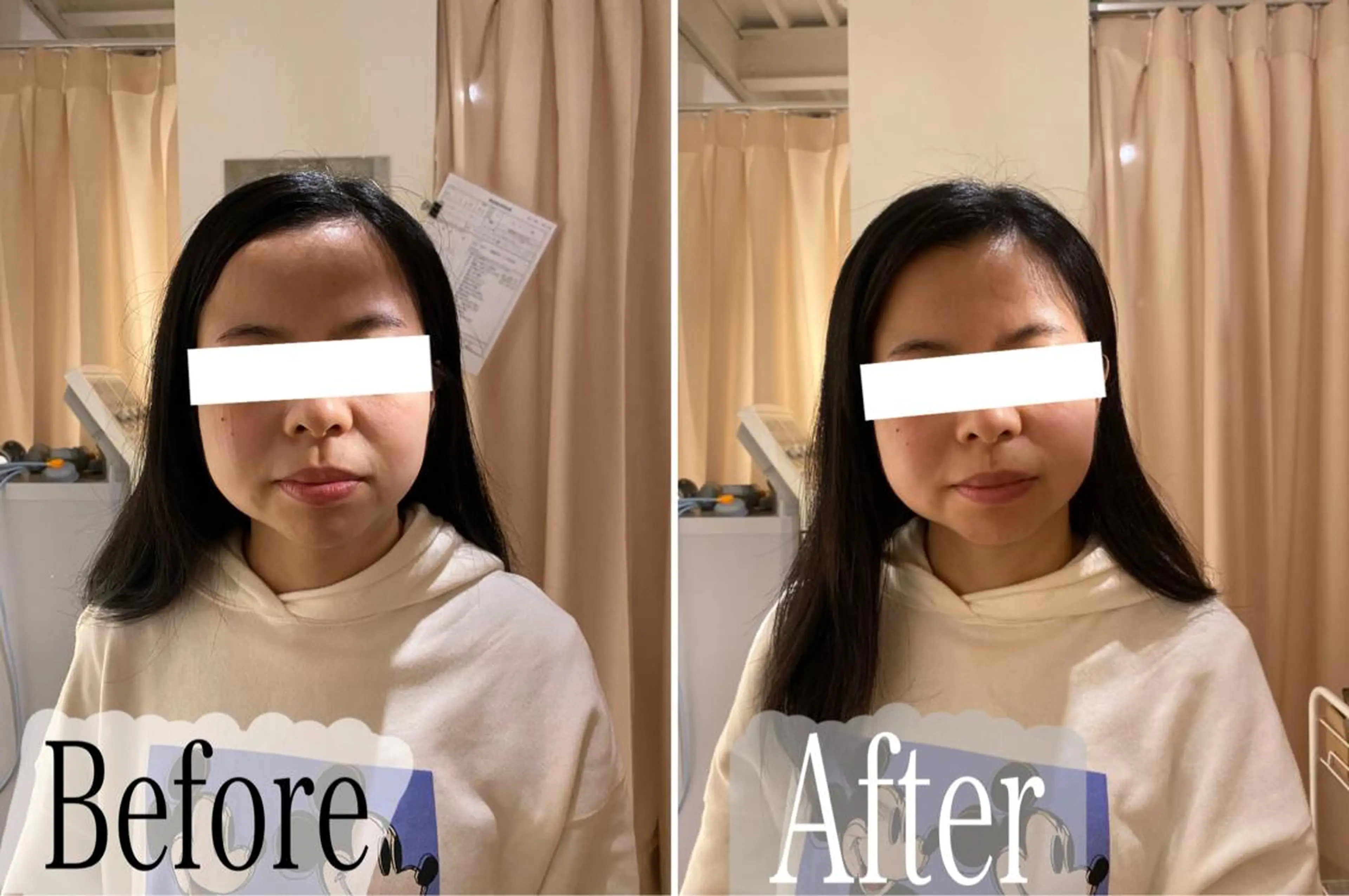 鍼灸 Refineのその他イメージ