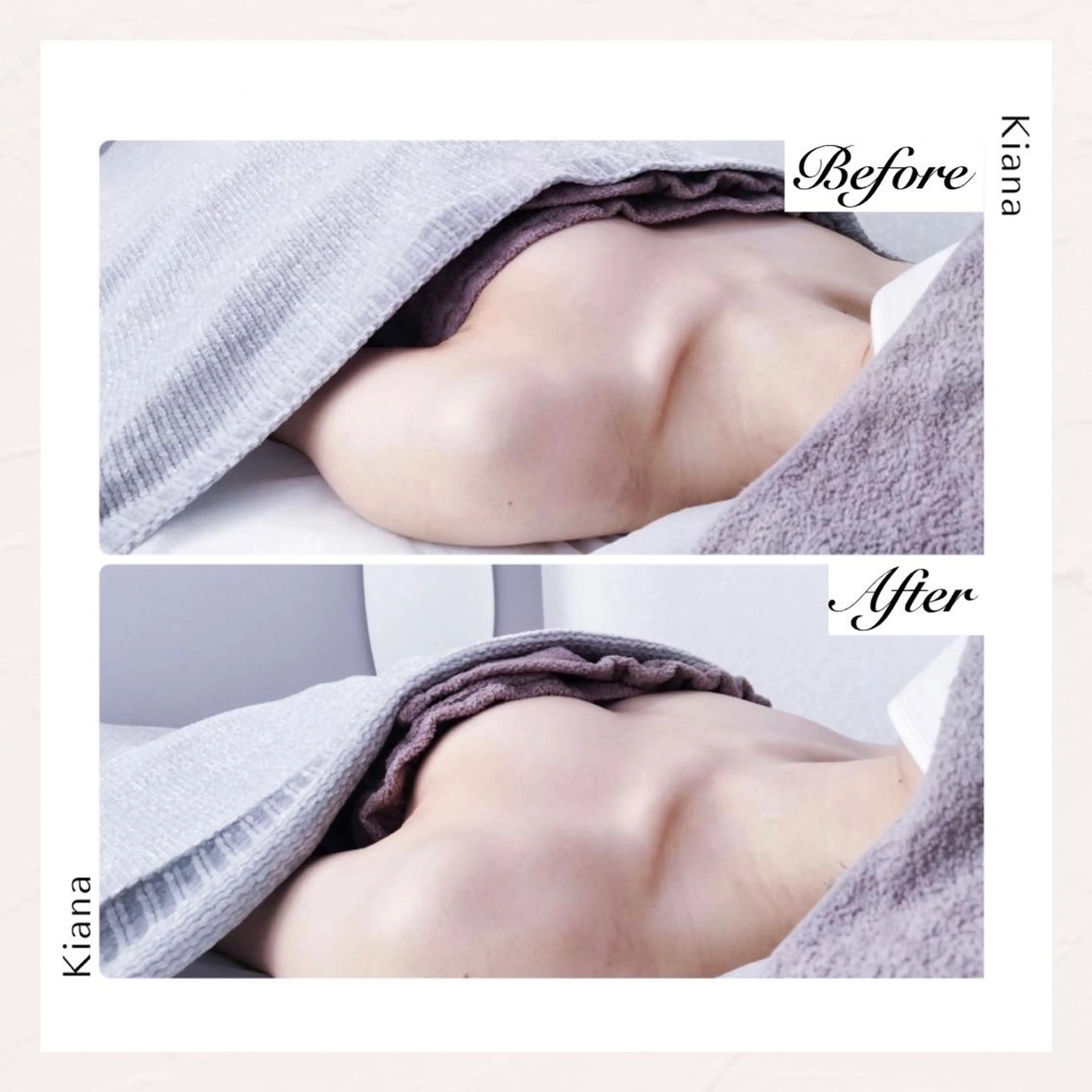 バスト専門Kiana 風のエステ・リラクイメージ