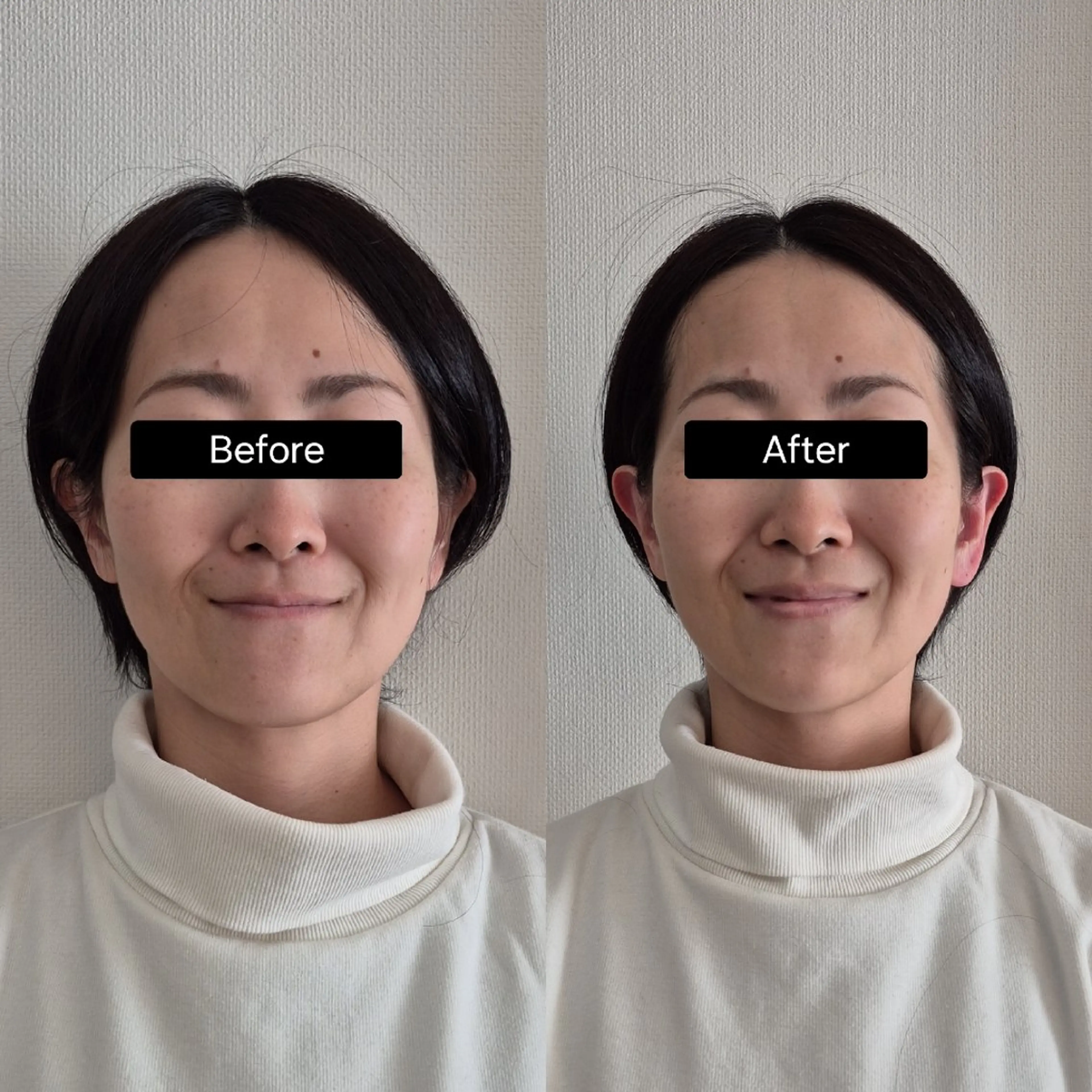 頭と顔の専門店LN│ ヘッドスパ×小顔矯正のエステ・リラクイメージ