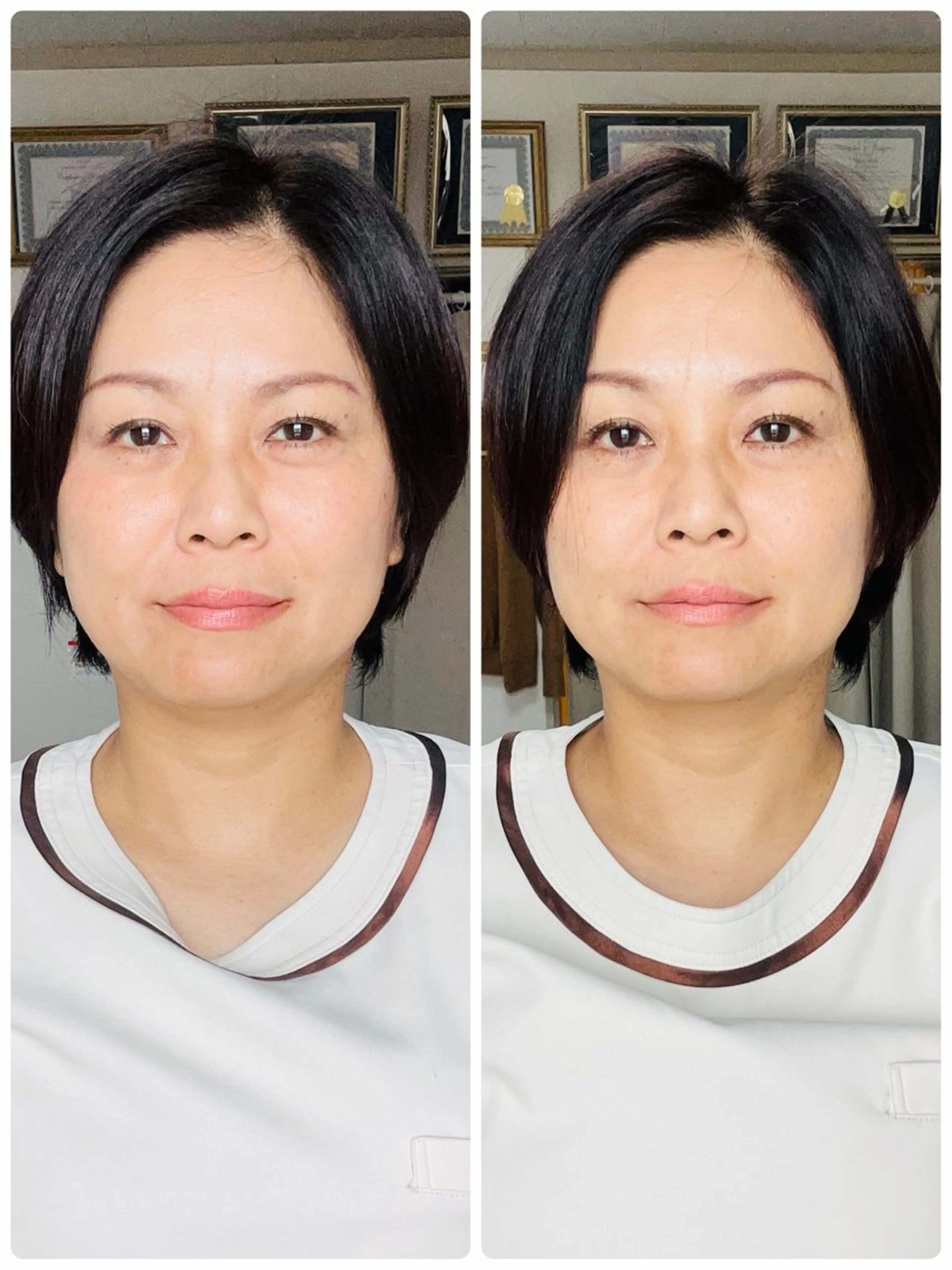 リンパケアサロンhokulani所属・さとう式小顔美容整体 hokulaniのエステ・リラクイメージ