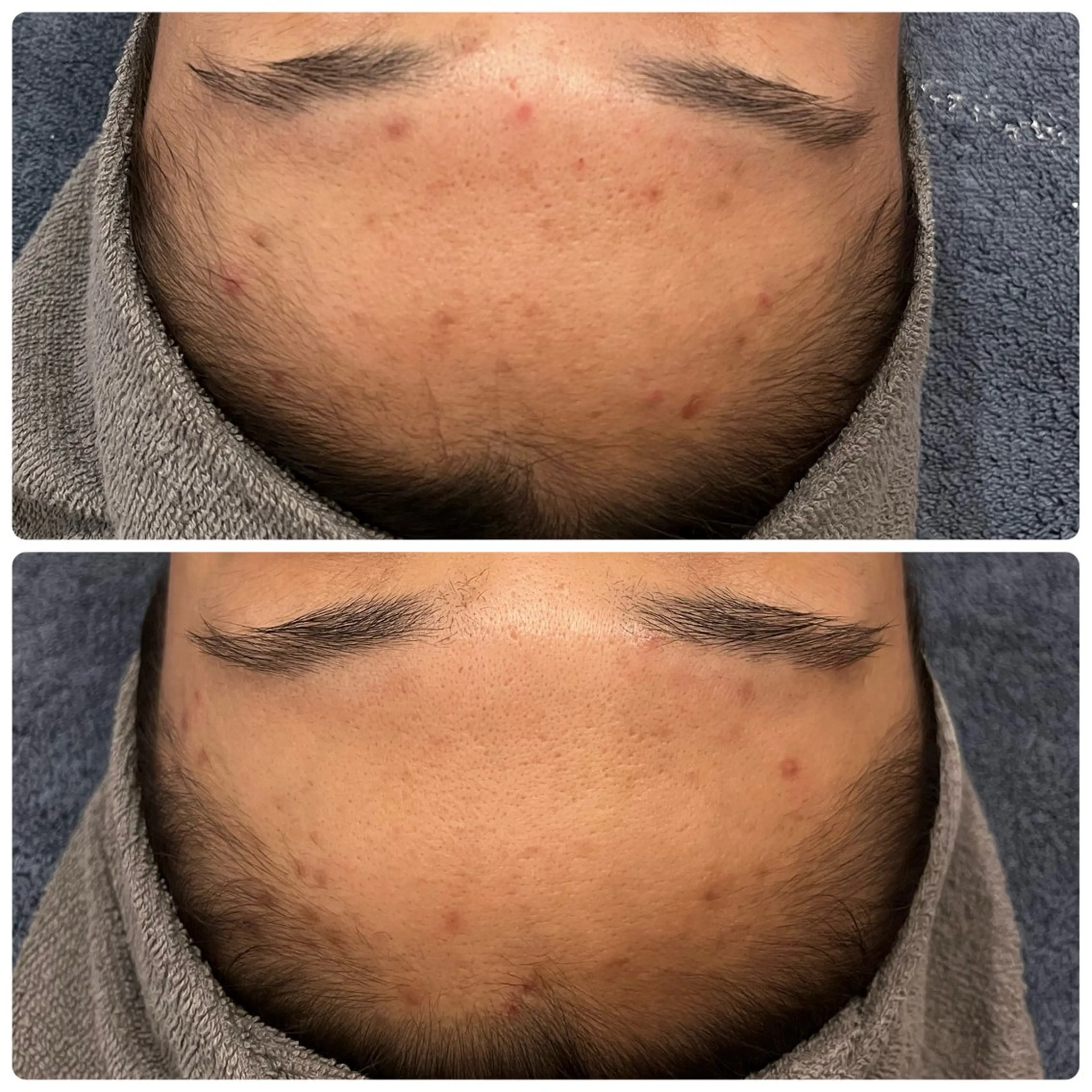 脱毛 yellow💛【 脱毛&フェイシャル】のエステ・リラクイメージ