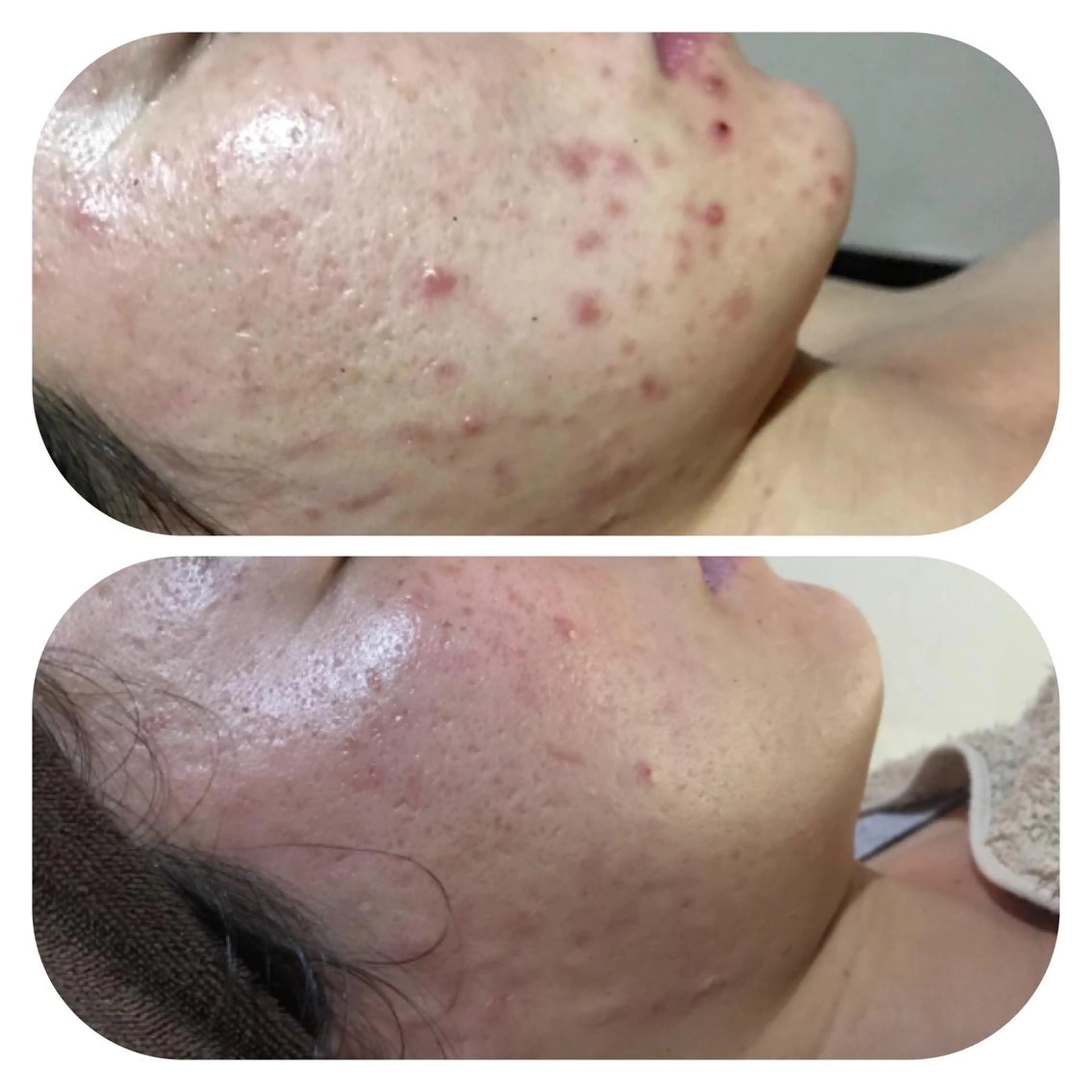 【足圧】鬼👹リンパ 身体整うサロンのエステ・リラクイメージ