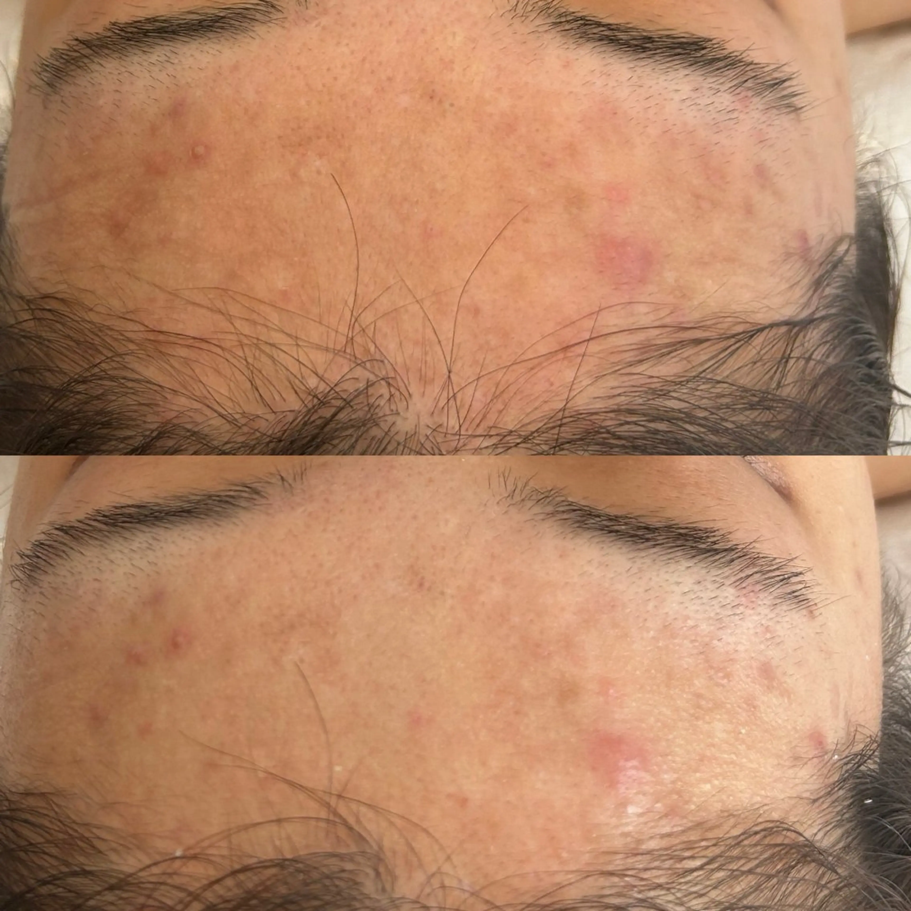 エステ 韓国🇰🇷価格 サロン_Nbibiの眉毛・アイブロウイメージ