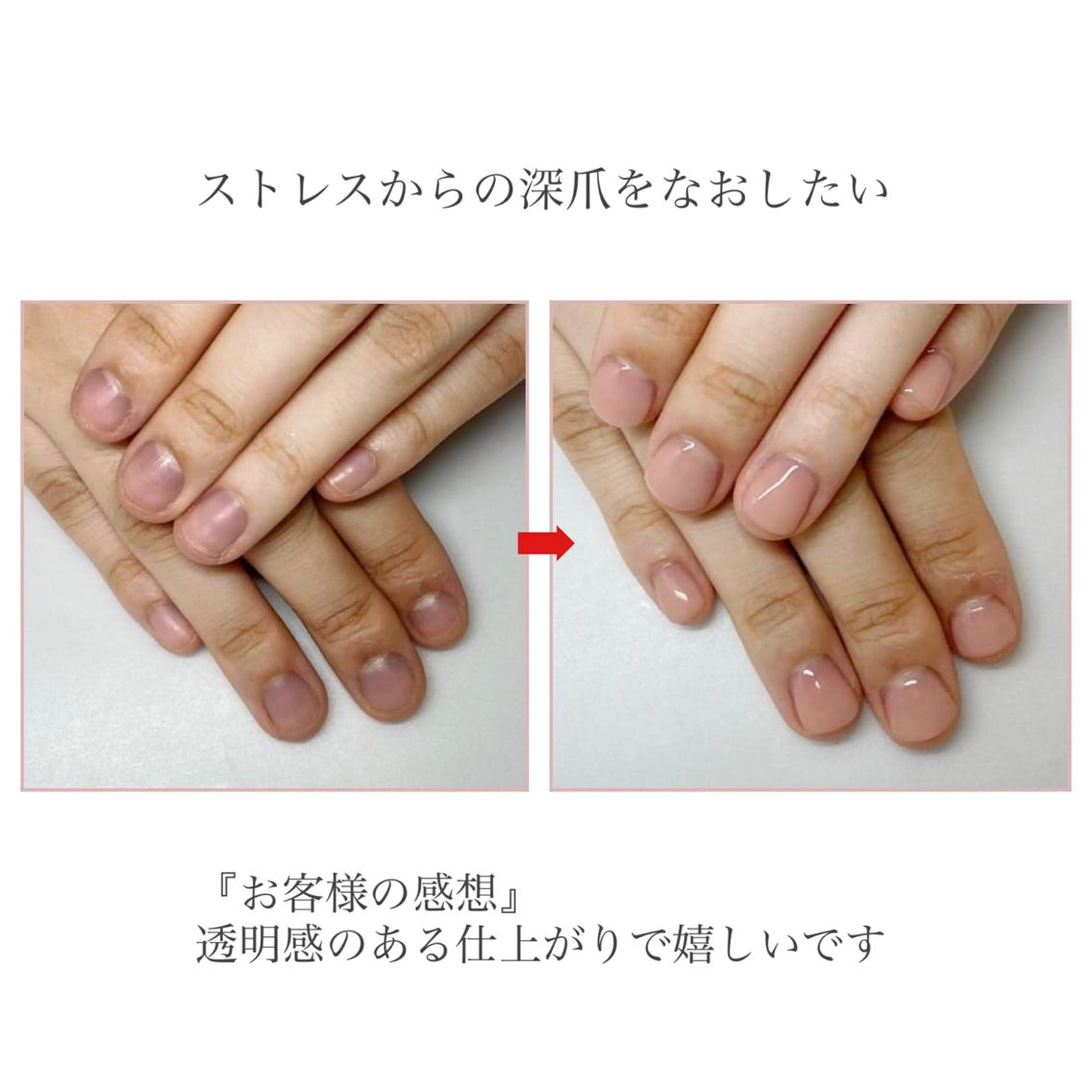 ネイル ネイルサロン アリュームのネイルデザイン