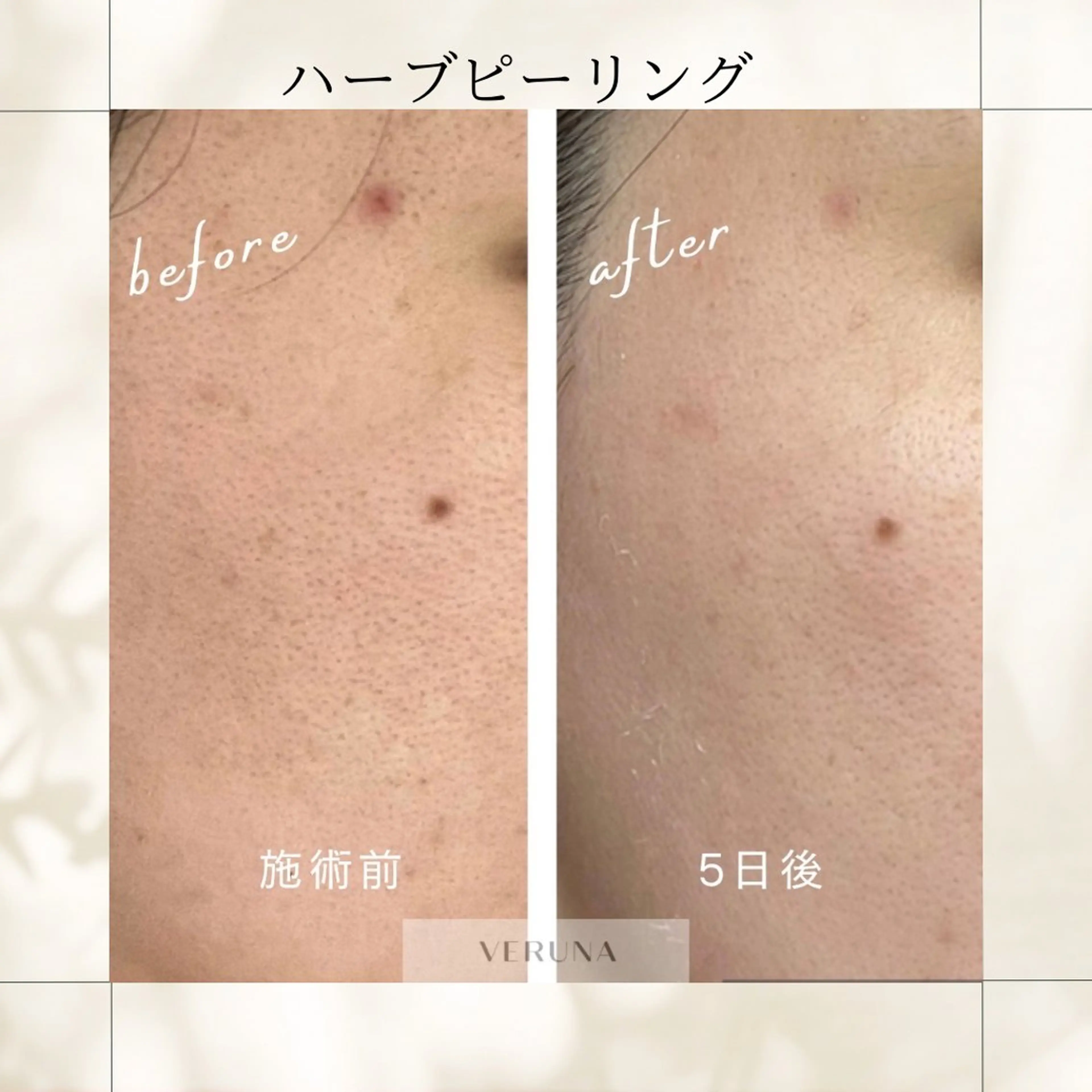 エステ リラク ピーリング専門店 Belluteのエステ・リラクイメージ