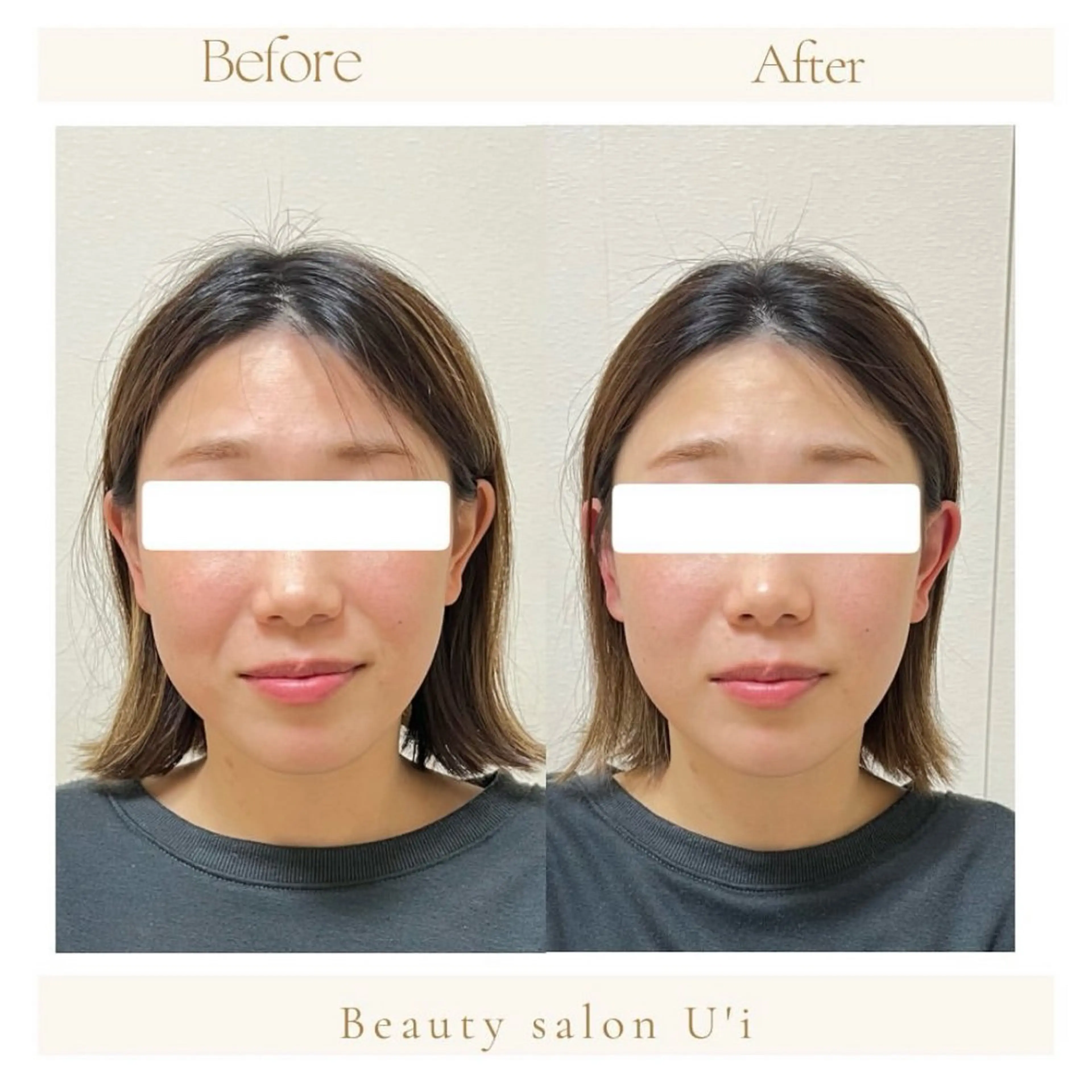 頭蓋骨小顔矯正 藤本のエステ・リラクイメージ