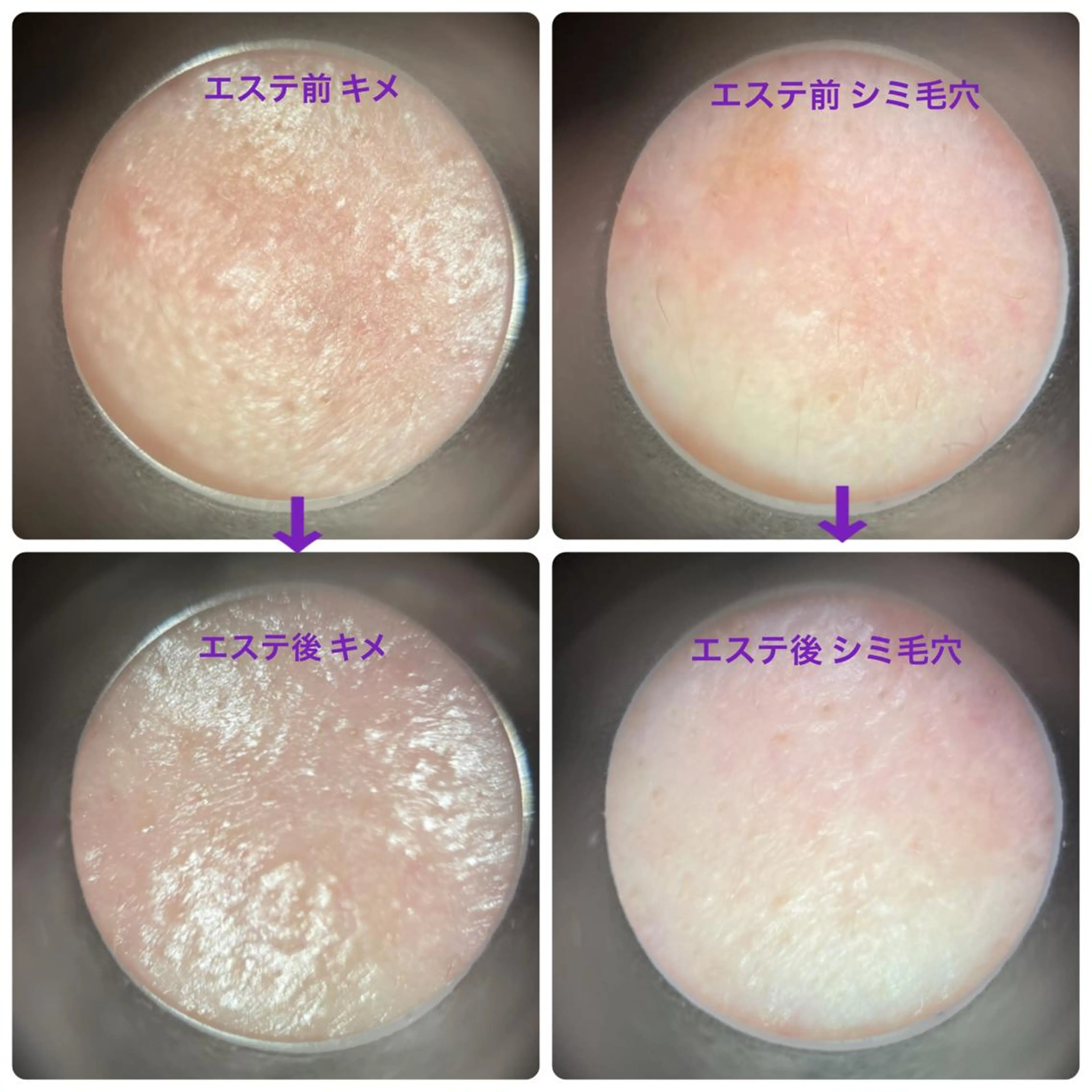 メナード昭和円上 いのうえのエステ・リラクイメージ