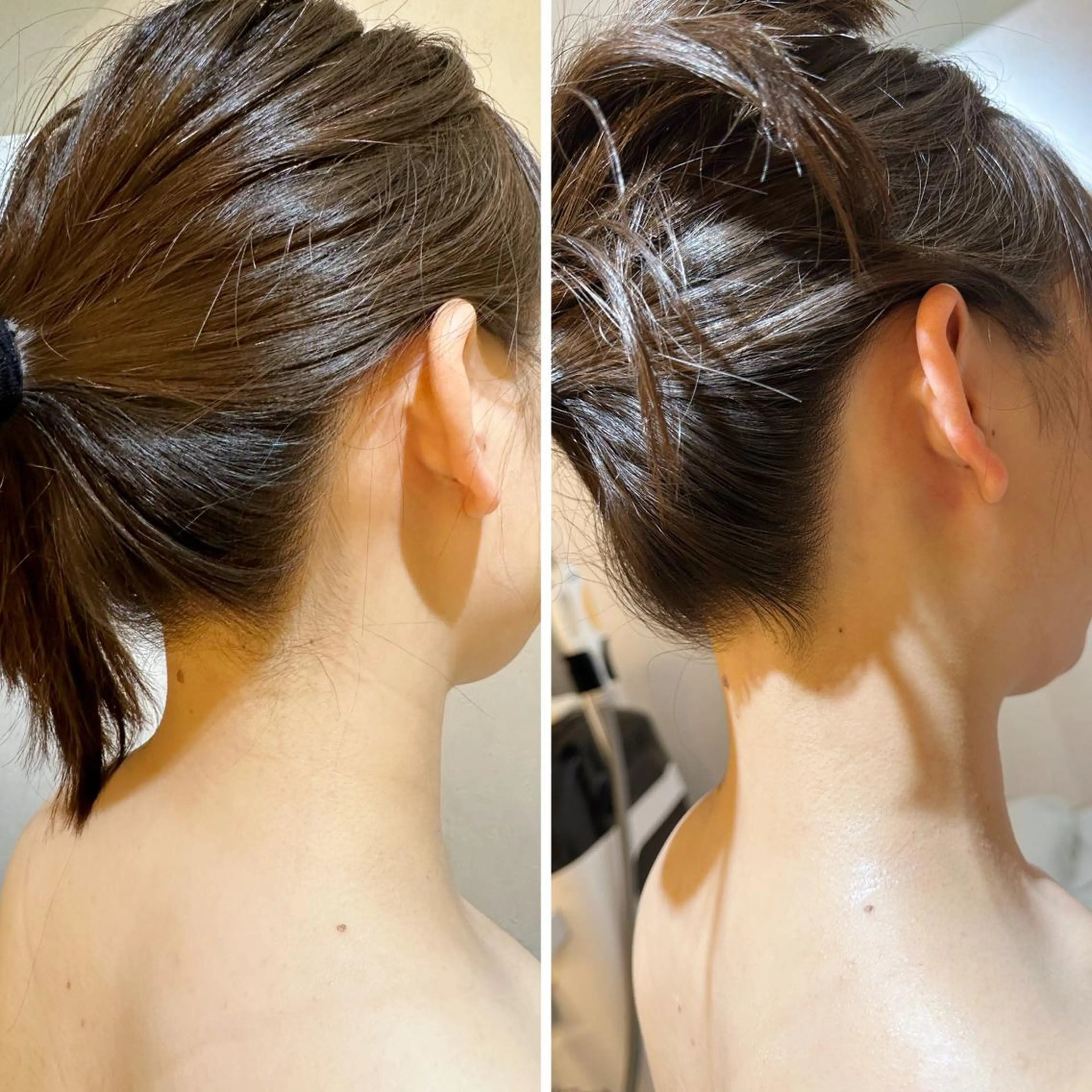 脱毛 うなじ脱毛/美肌脱毛 LABELのエステ・リラクイメージ