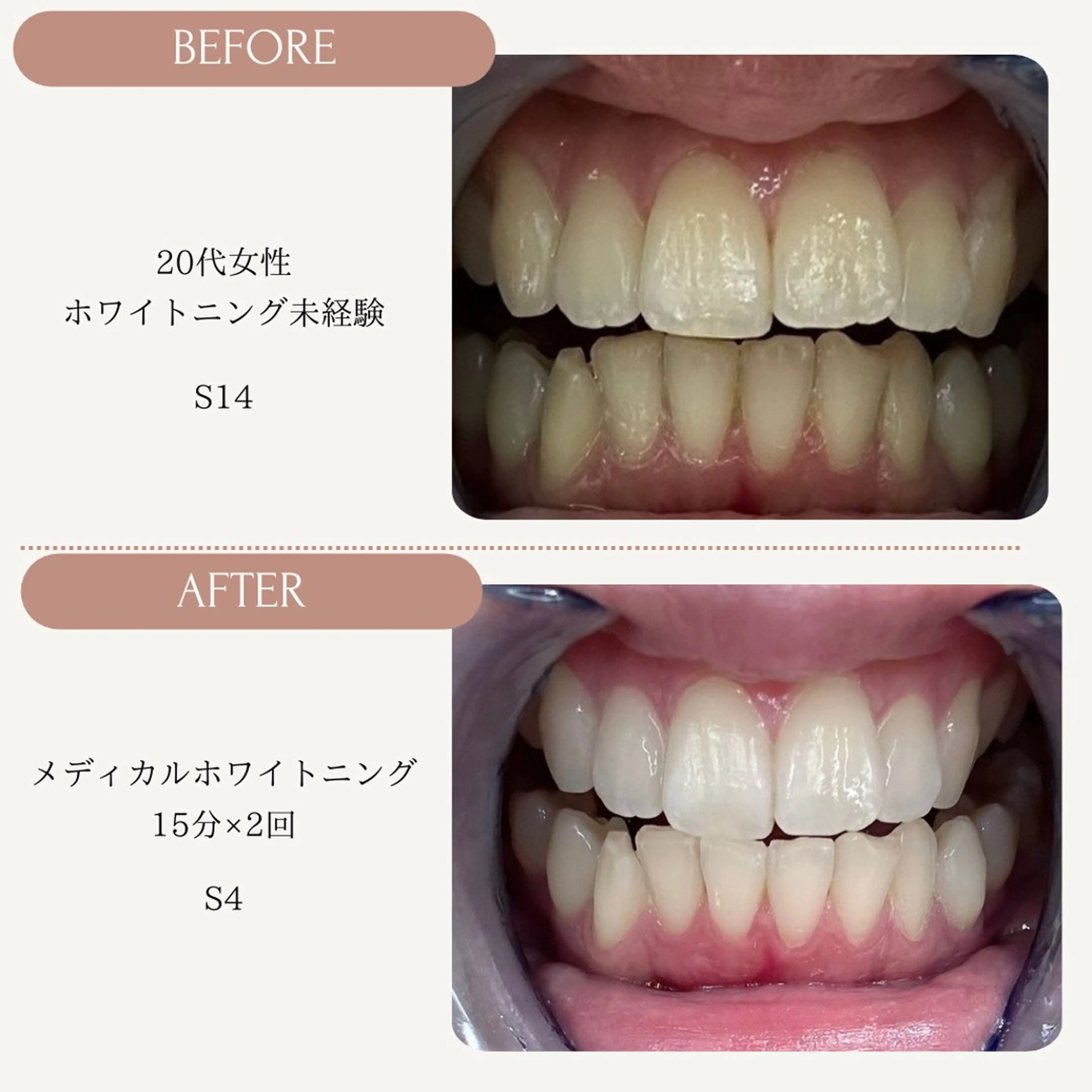 ホワイトニング カラット 恵比寿店のエステ・リラクイメージ