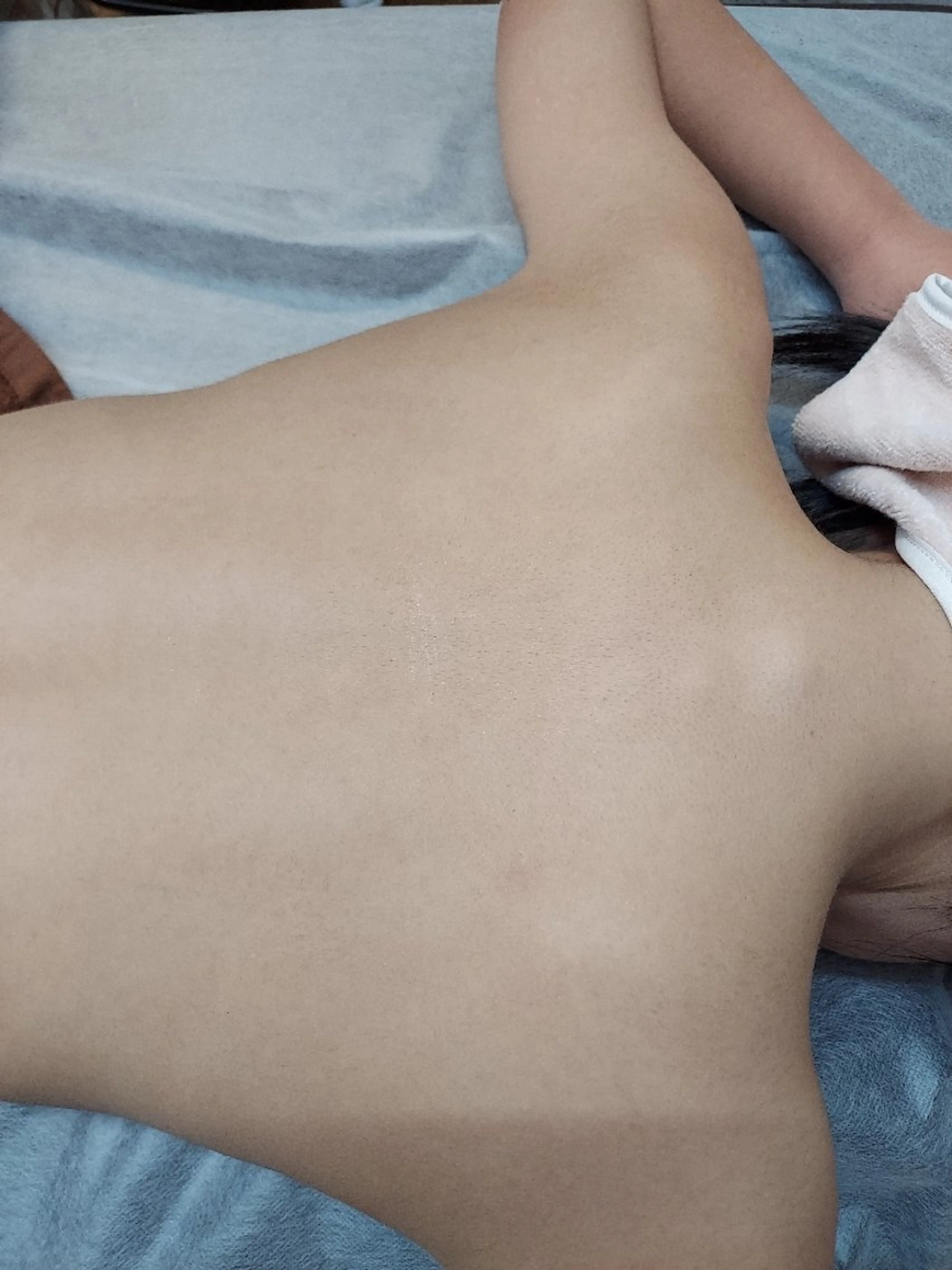 ●全身脱毛●チクチクお肌を“うるツヤ”へ(顔VIOあり)ミニモ限定●女性の写真