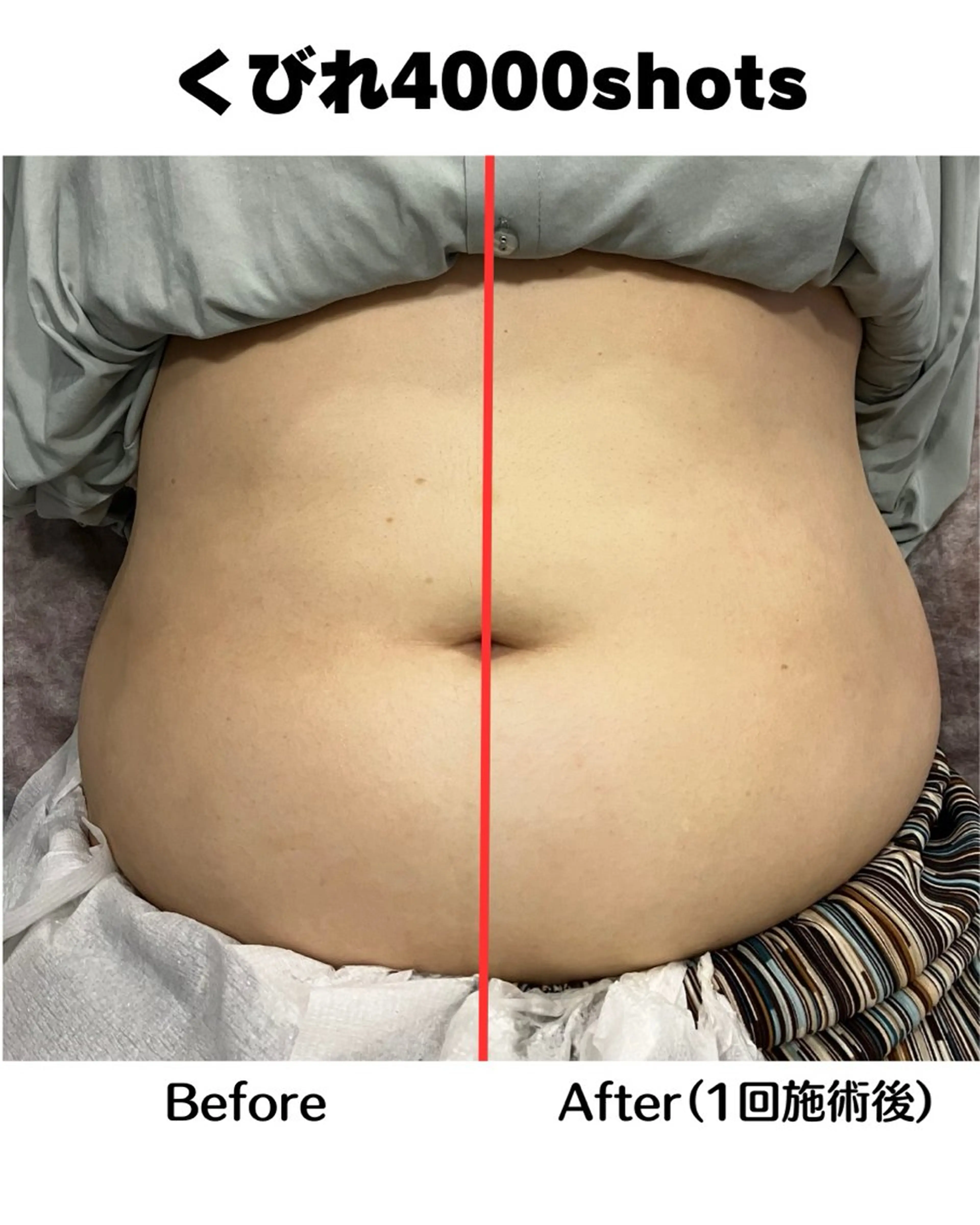 Clear Canvasのエステ・リラクイメージ