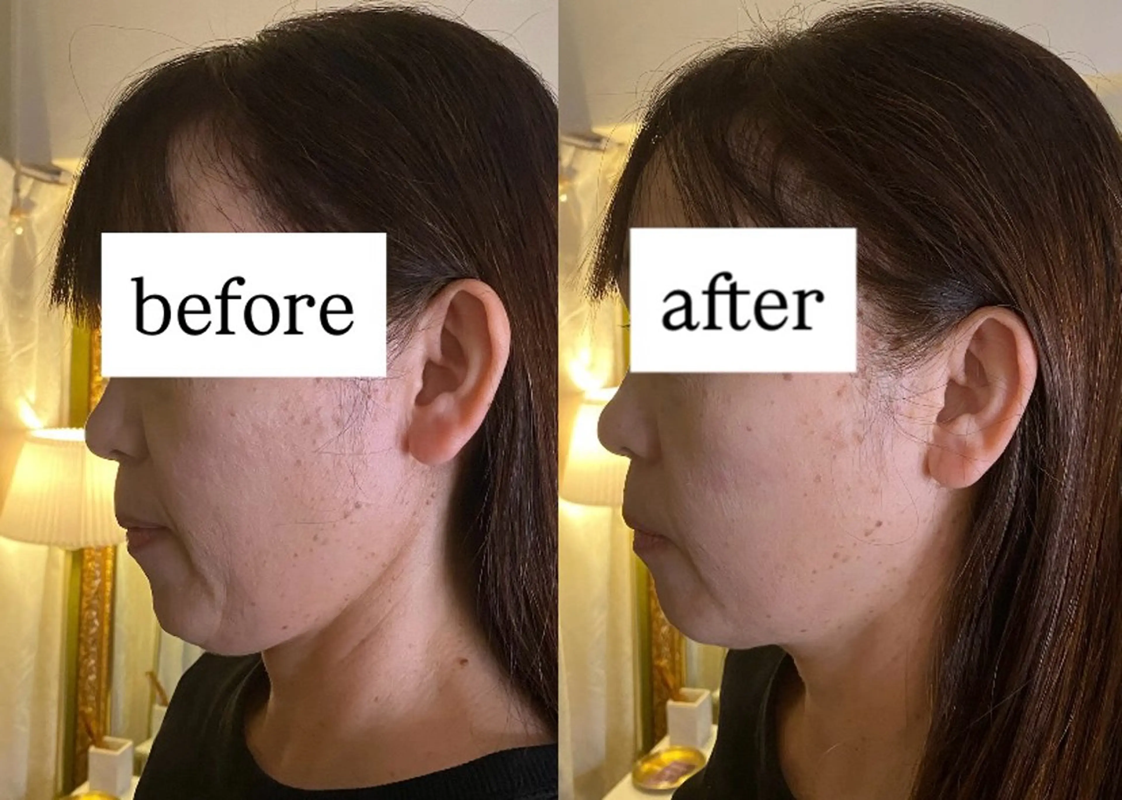 天神美容鍼99 -KUKU-吉弘萌香のエステ・リラクイメージ