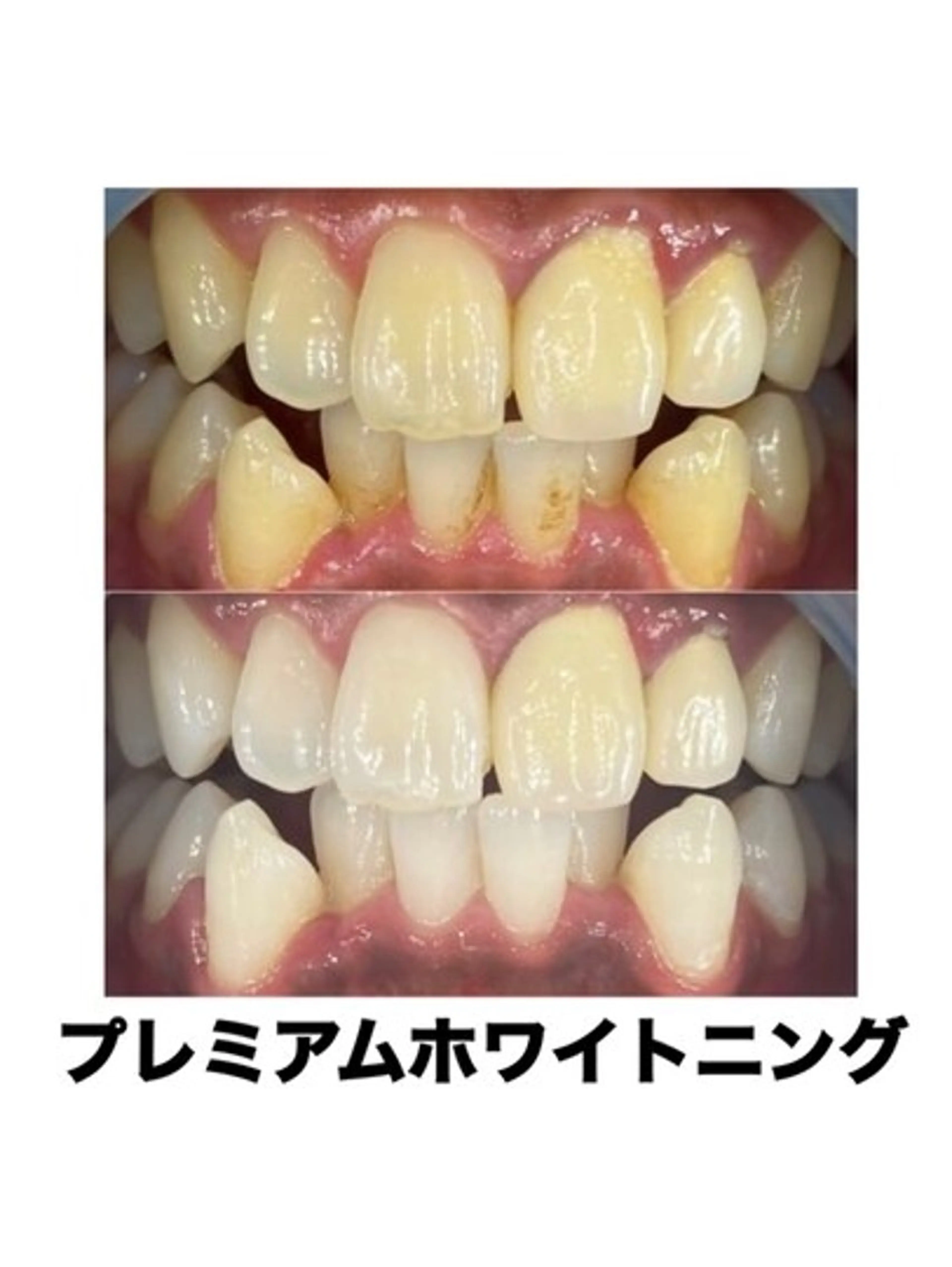 ホワイトニングカフェ藤が丘店所属・ホワイトニングカフェ 藤が丘のその他イメージ