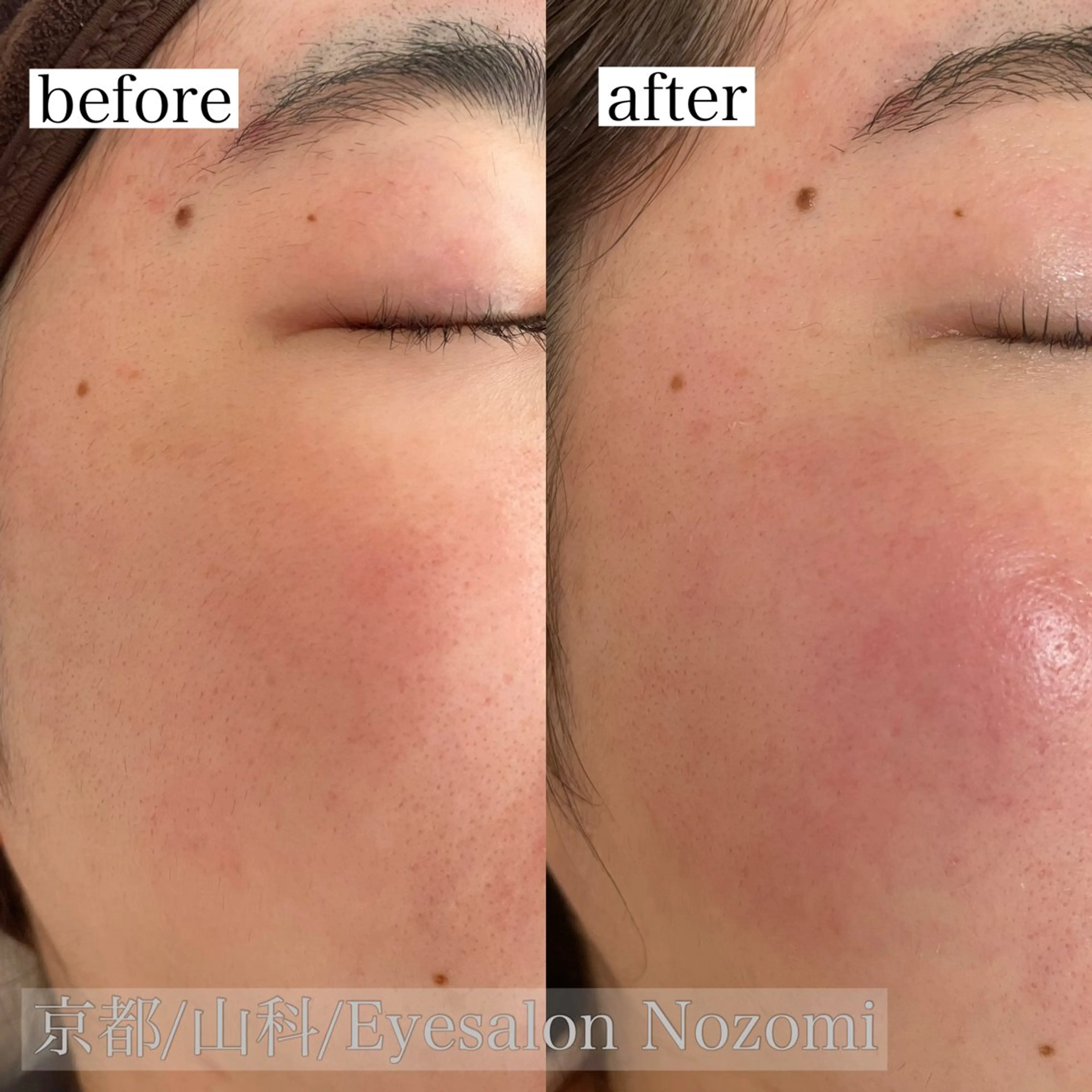 脱毛 Eyesalon Nozomiのマツエク・マツパデザイン