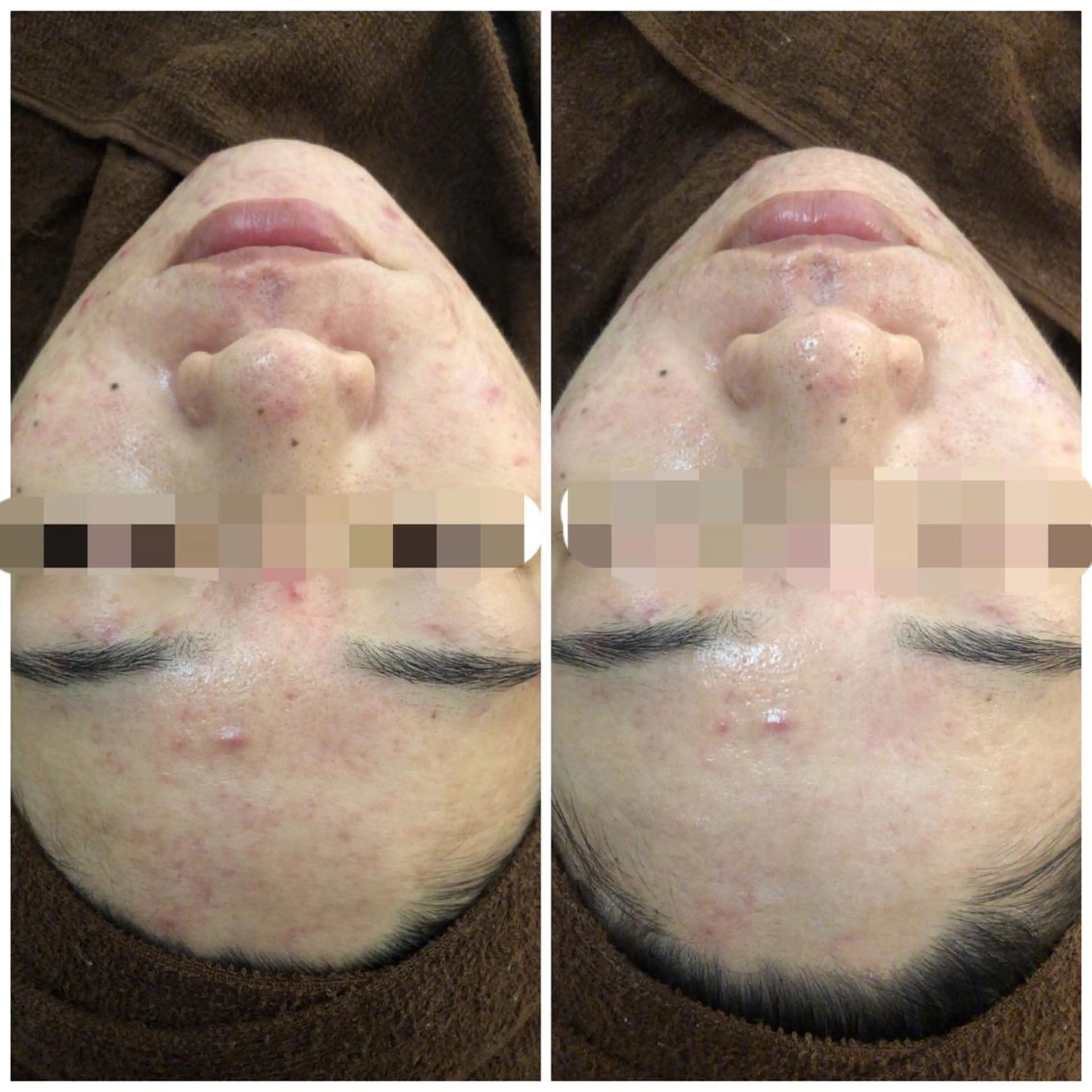 ロング カラー パーマ ヘアアレンジ メンズ キッズ ネイル マツエク・マツパ Amaryllis 🌹のエステ・リラクイメージ