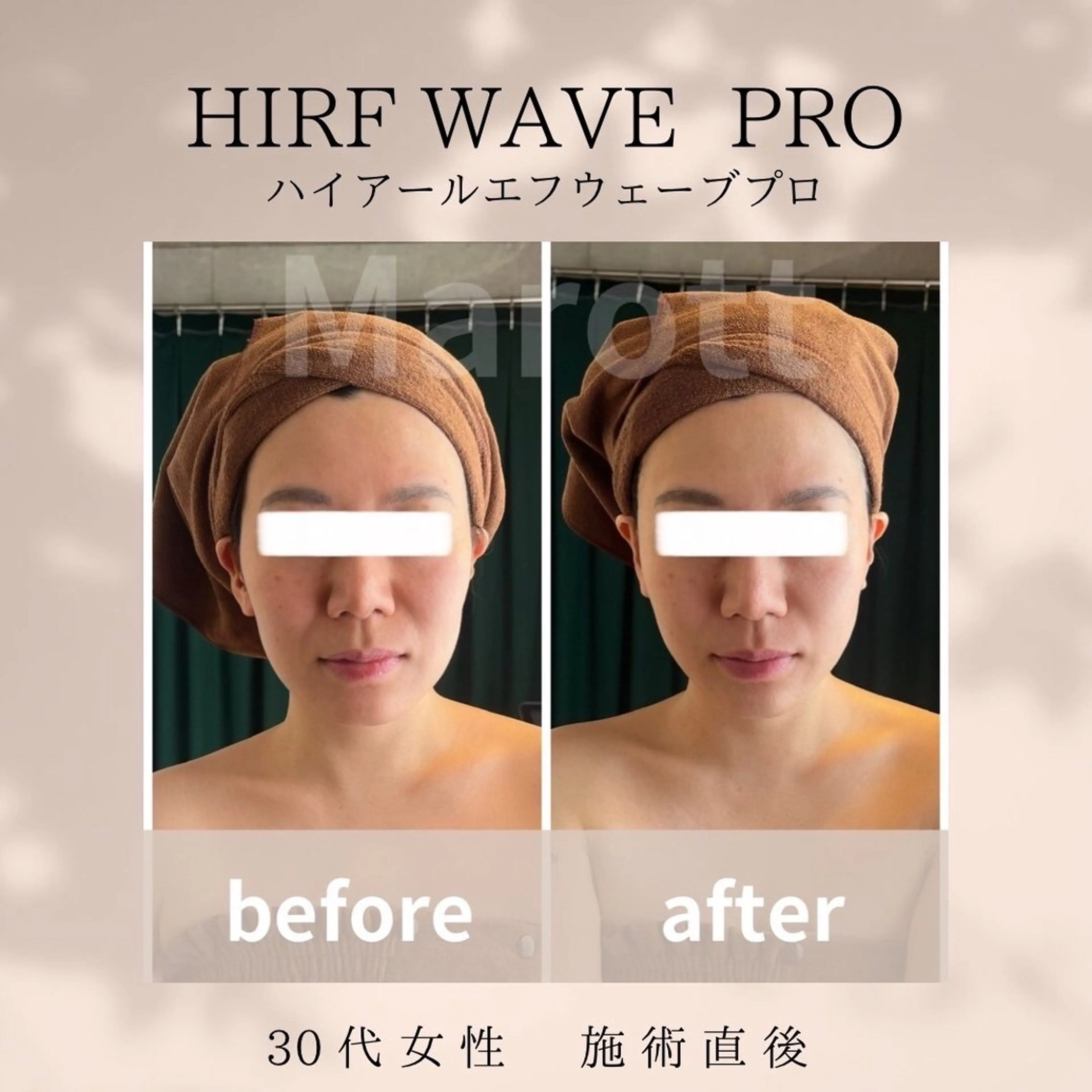 小顔サロン Marottのエステ・リラクイメージ