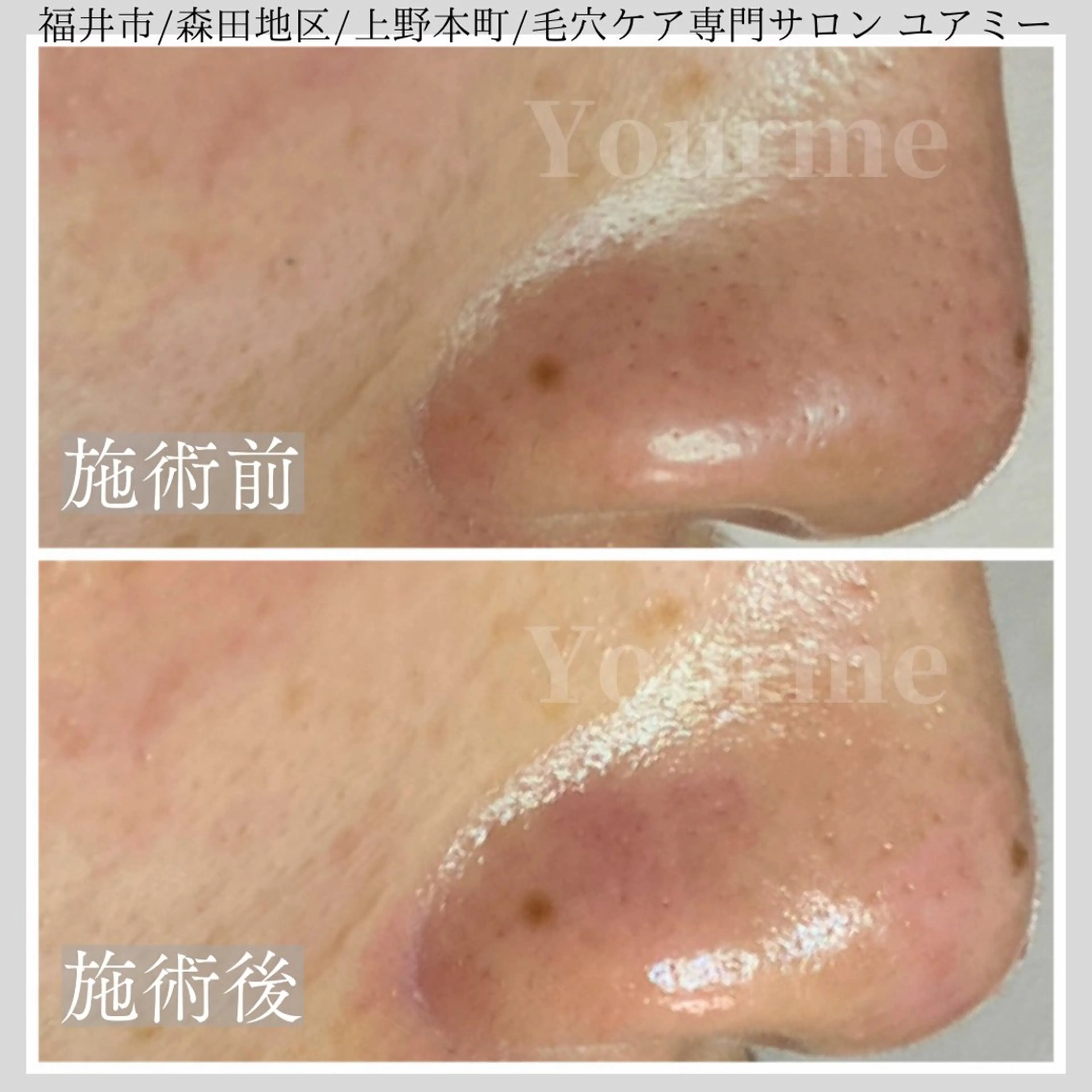 毛穴肌質ケアサロン Yourmeユアミーのエステ・リラクイメージ