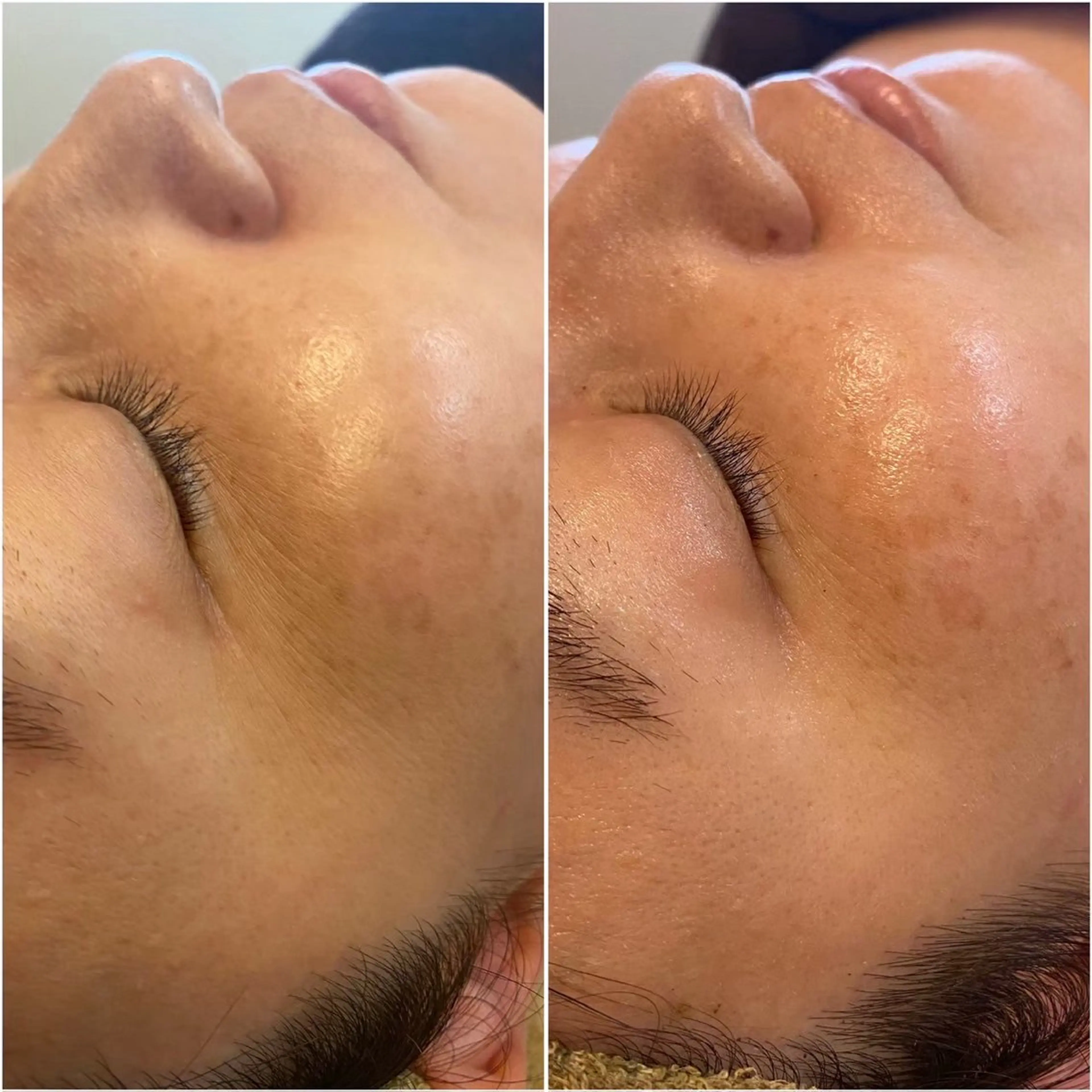 肌に自信のない人 専門サロンのエステ・リラクイメージ