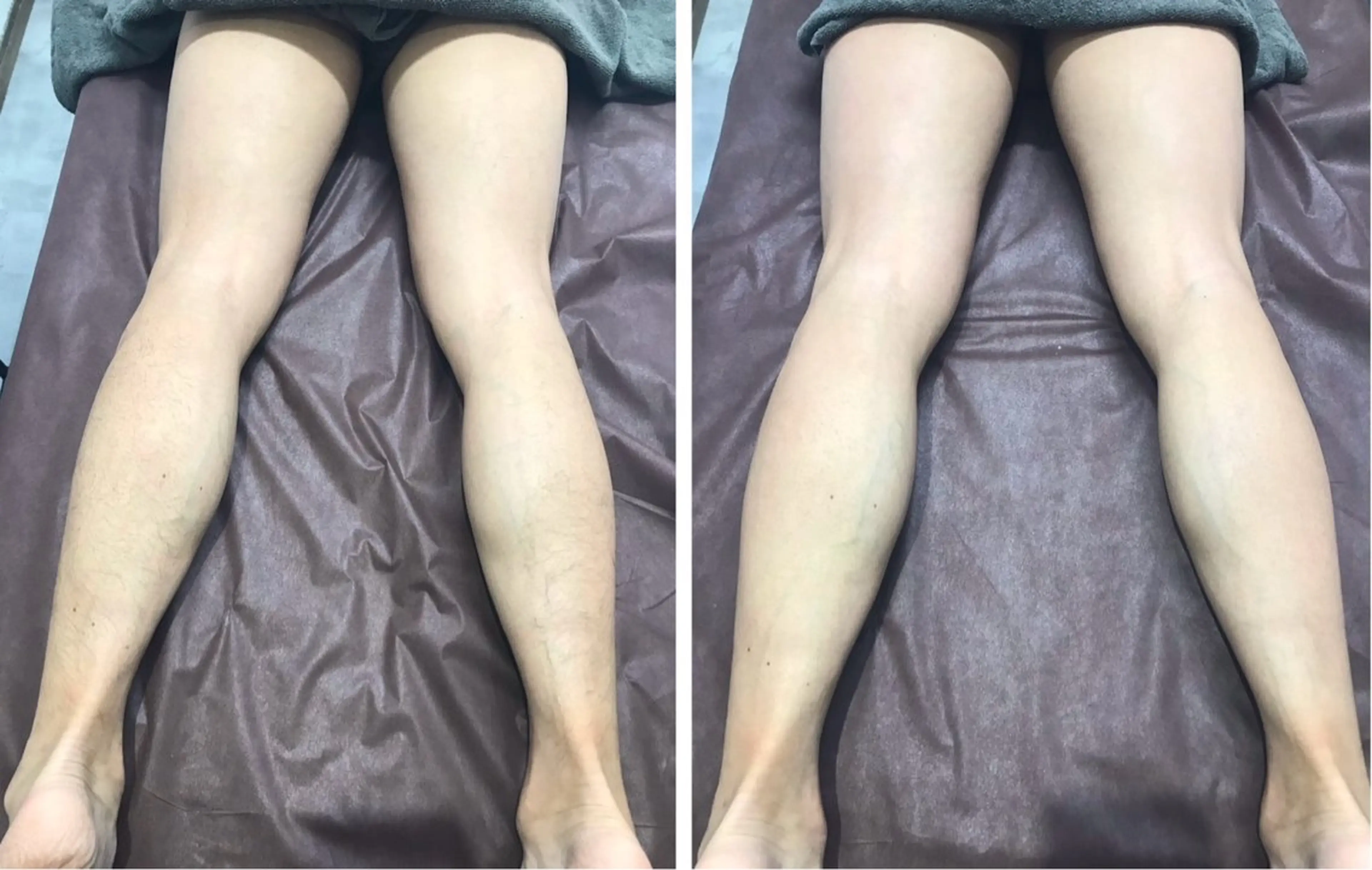 守口 Re:Lineのエステ・リラクイメージ