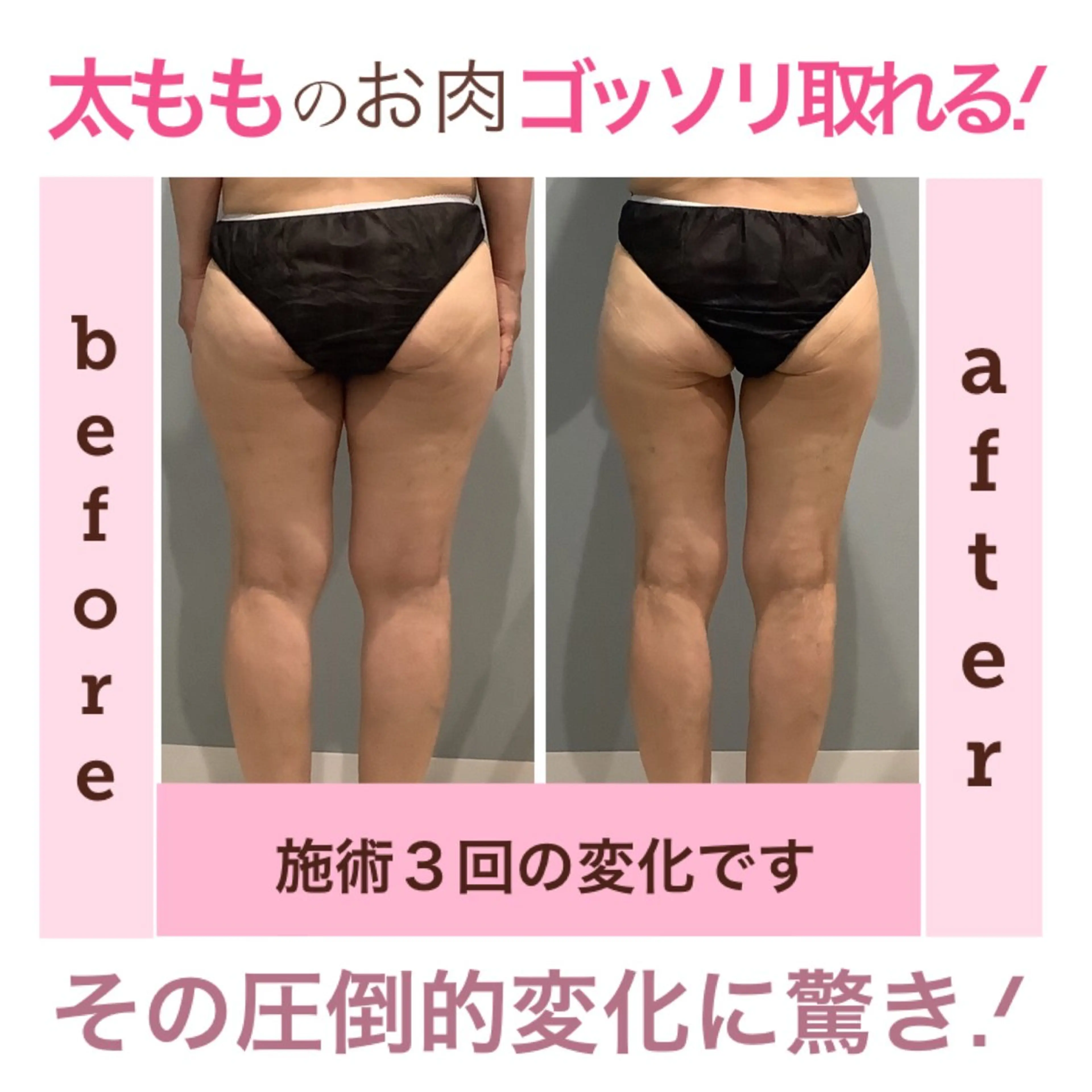 エステ エステサロン JURISのエステ・リラクイメージ