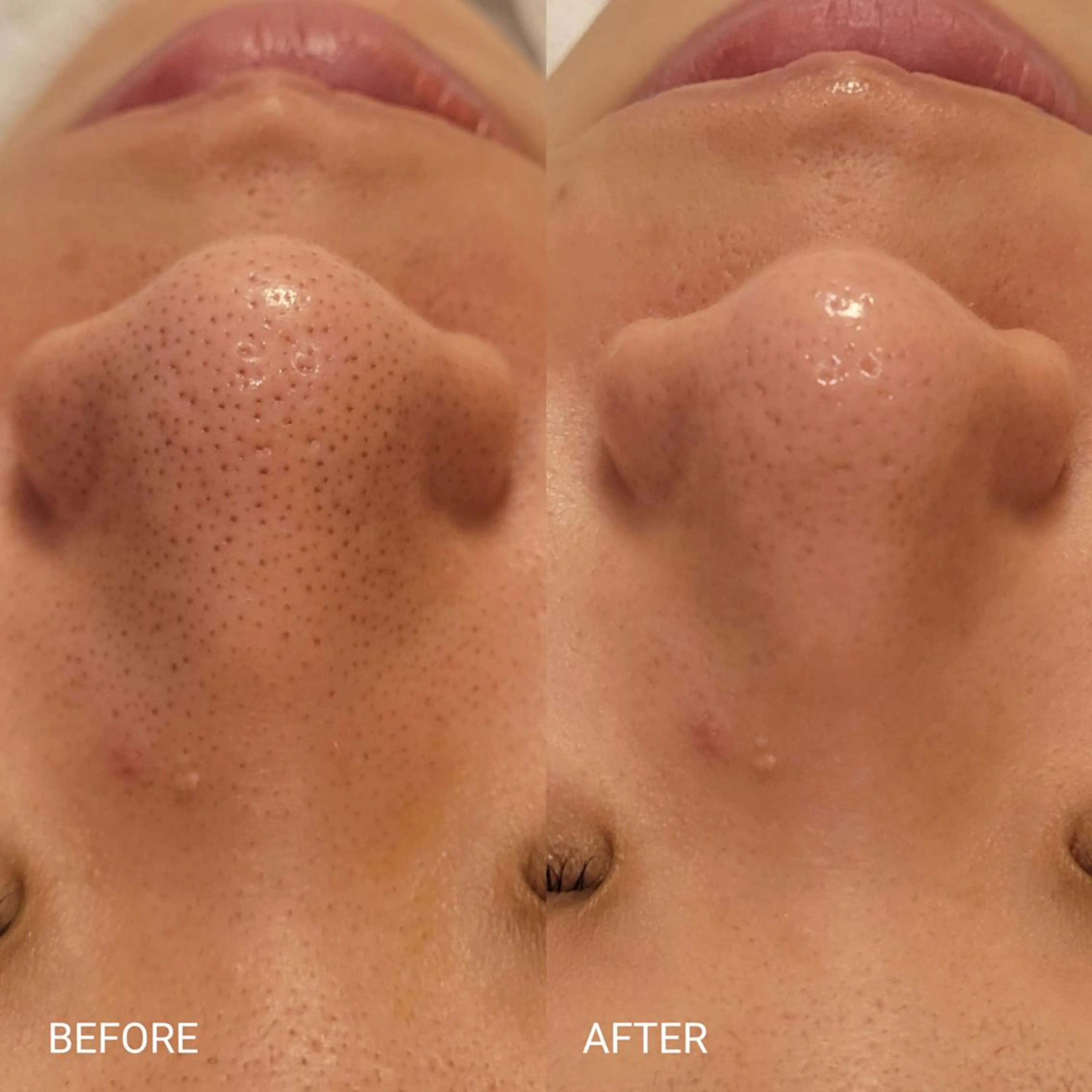 エステ サロンドフララ 表参道店のエステ・リラクイメージ