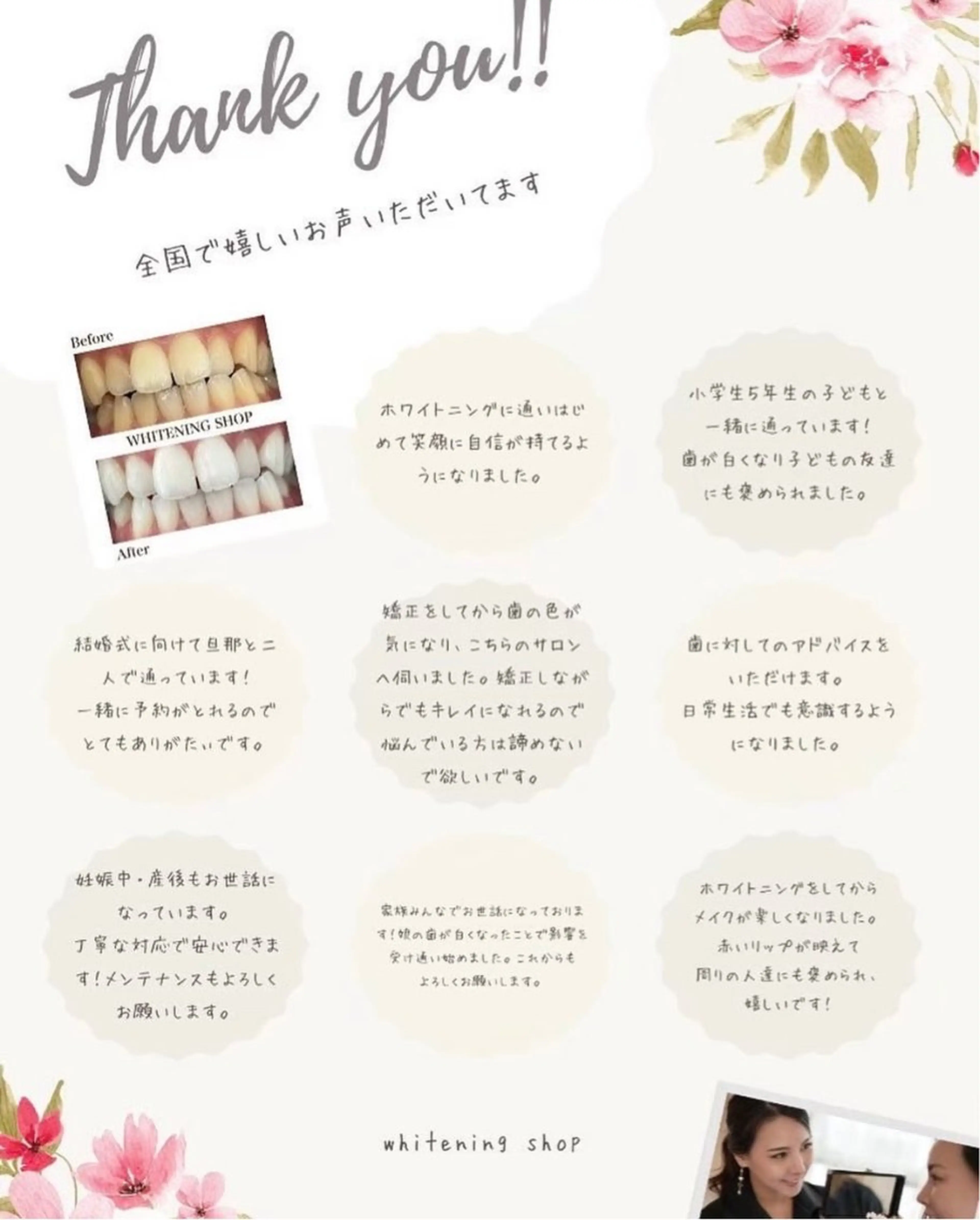 ホワイトニング ショップ伊丹店のその他イメージ