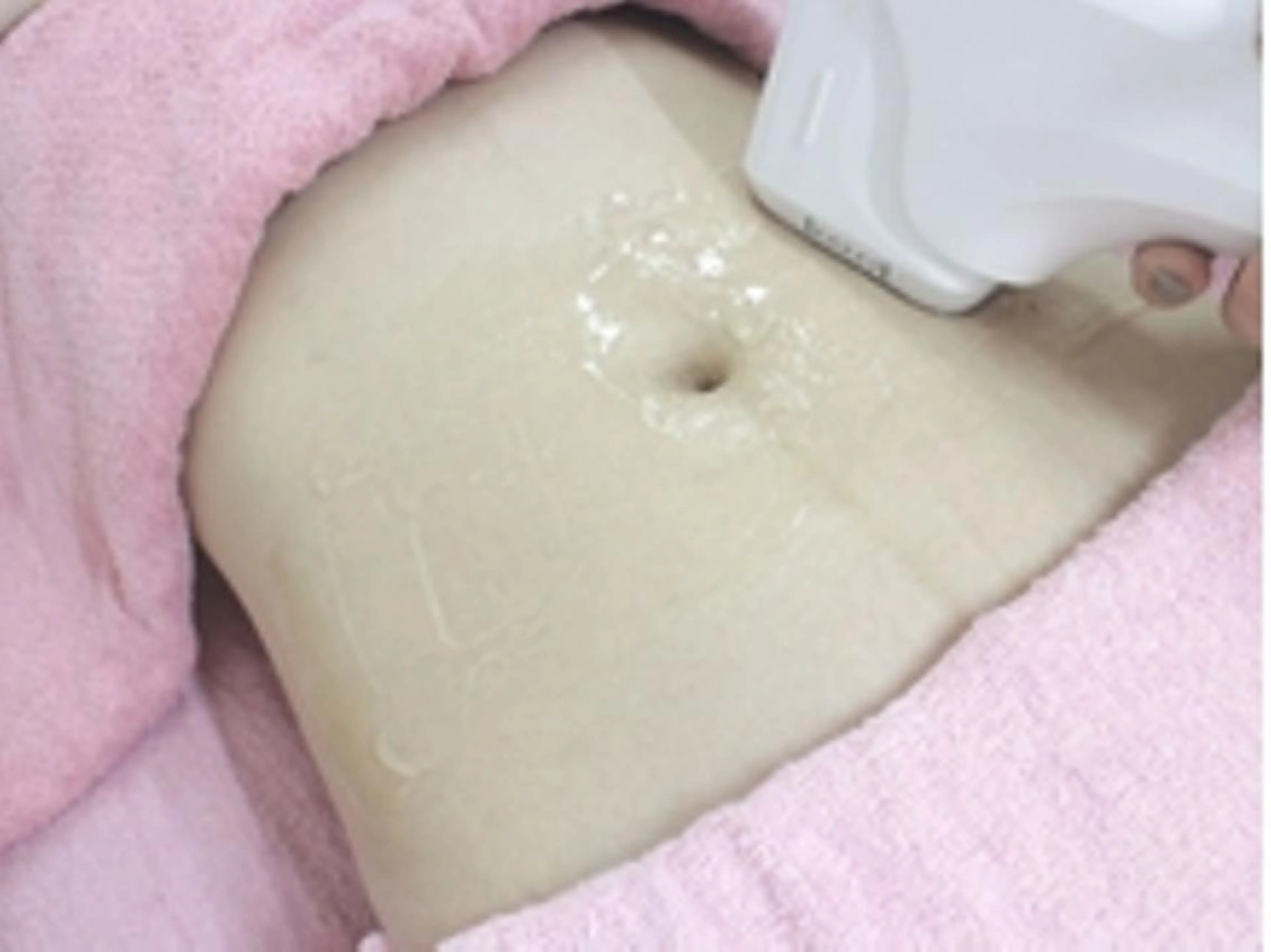 【minimo限定★クーポン】最新３D痩身プレミアムマシンGRAXIA　ウエスト集中！1回 ¥19,800の写真