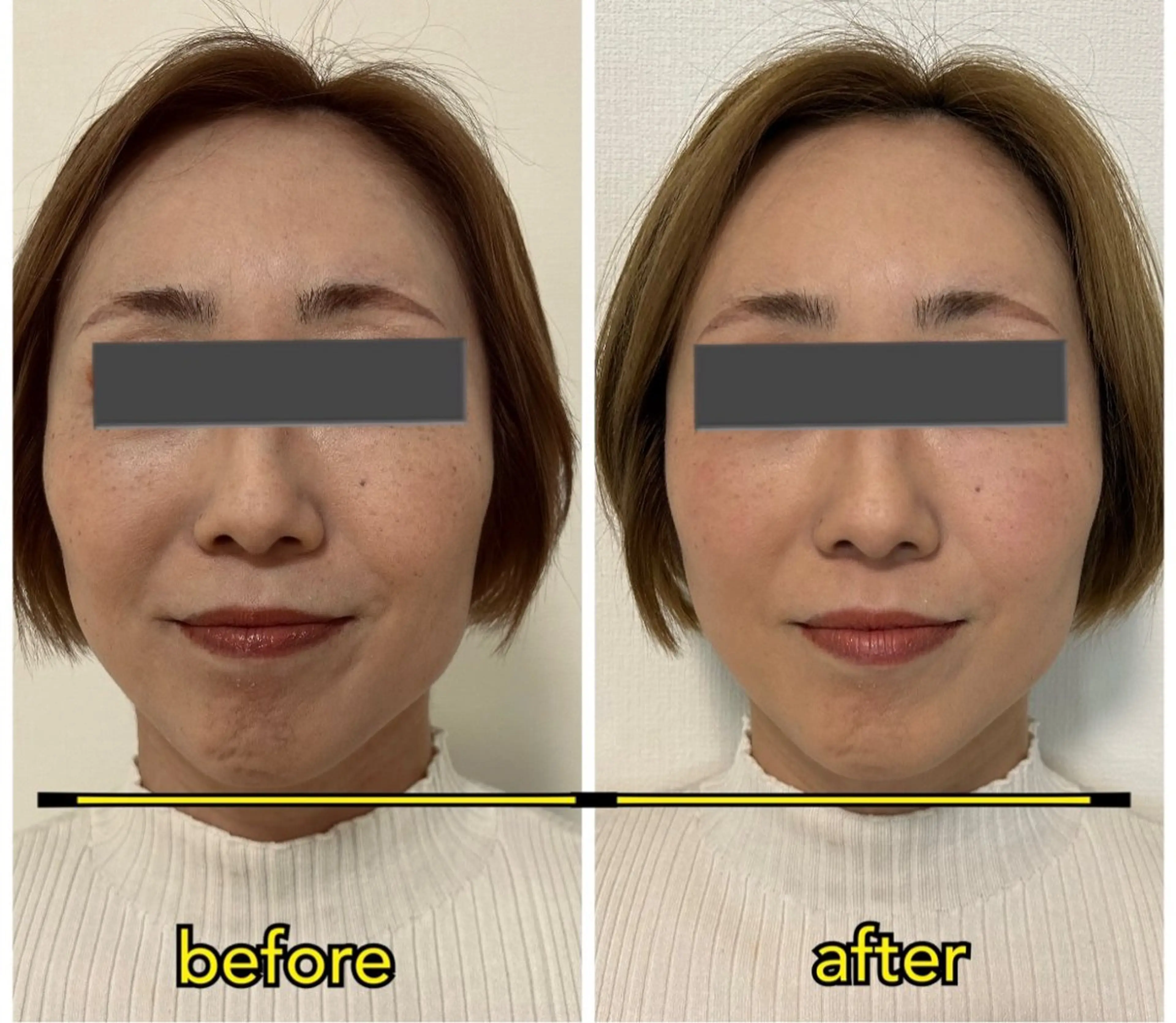 カイロプラクティック アンズ（営業電話✖️のエステ・リラクイメージ