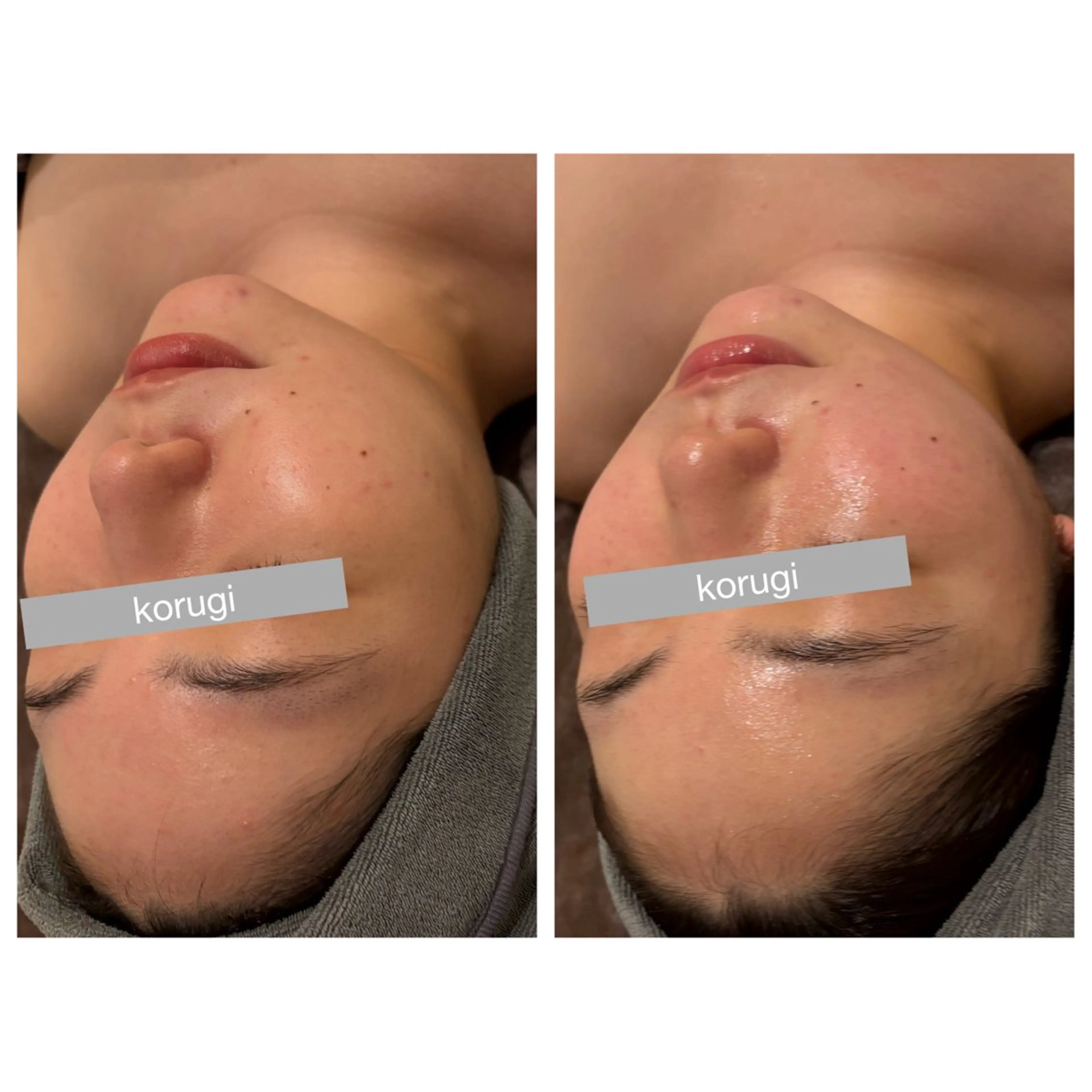 小顔コルギ ☆表参道/外苑前のエステ・リラクイメージ