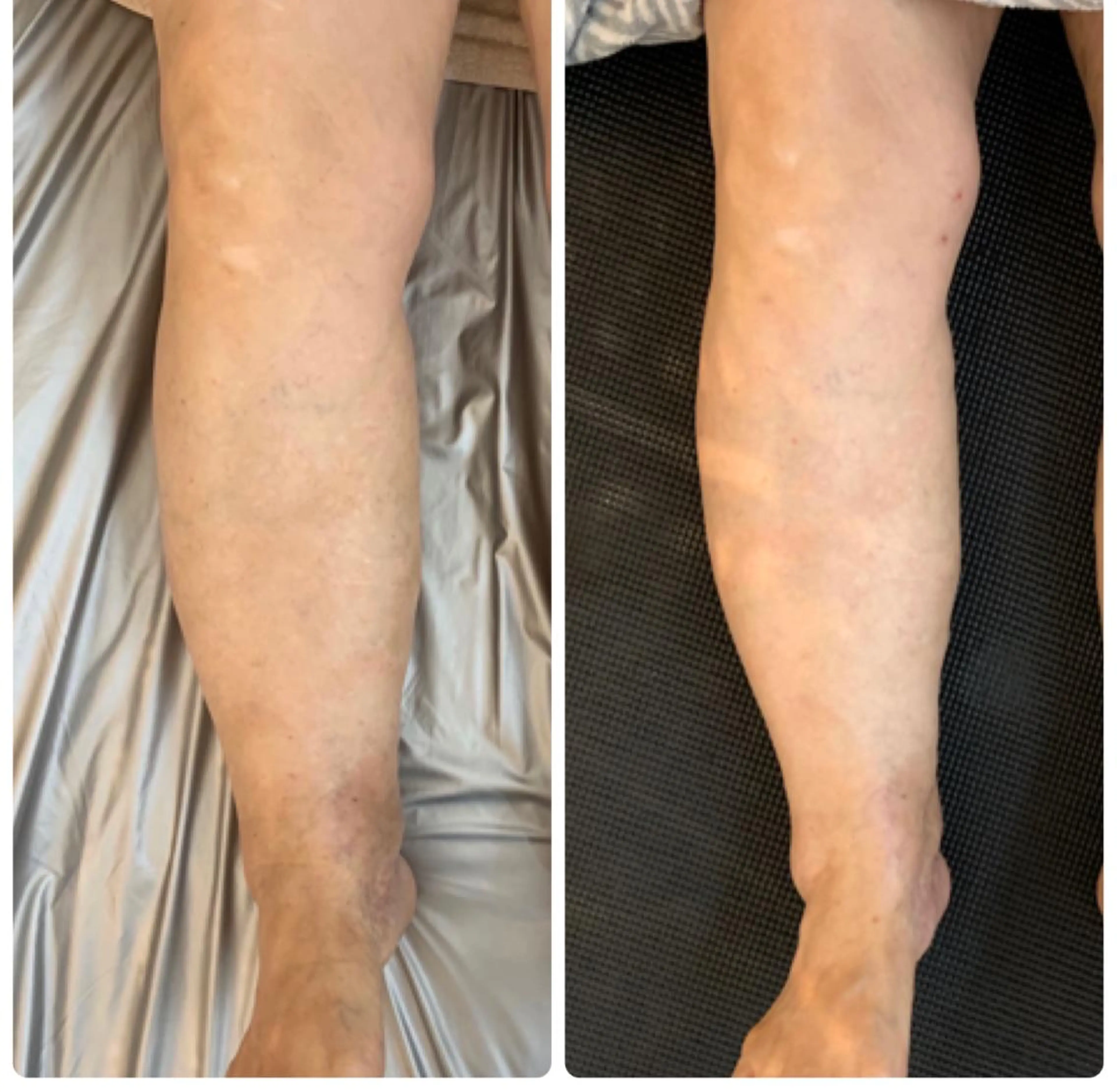 リンパとデトックス LAFUFUのエステ・リラクイメージ