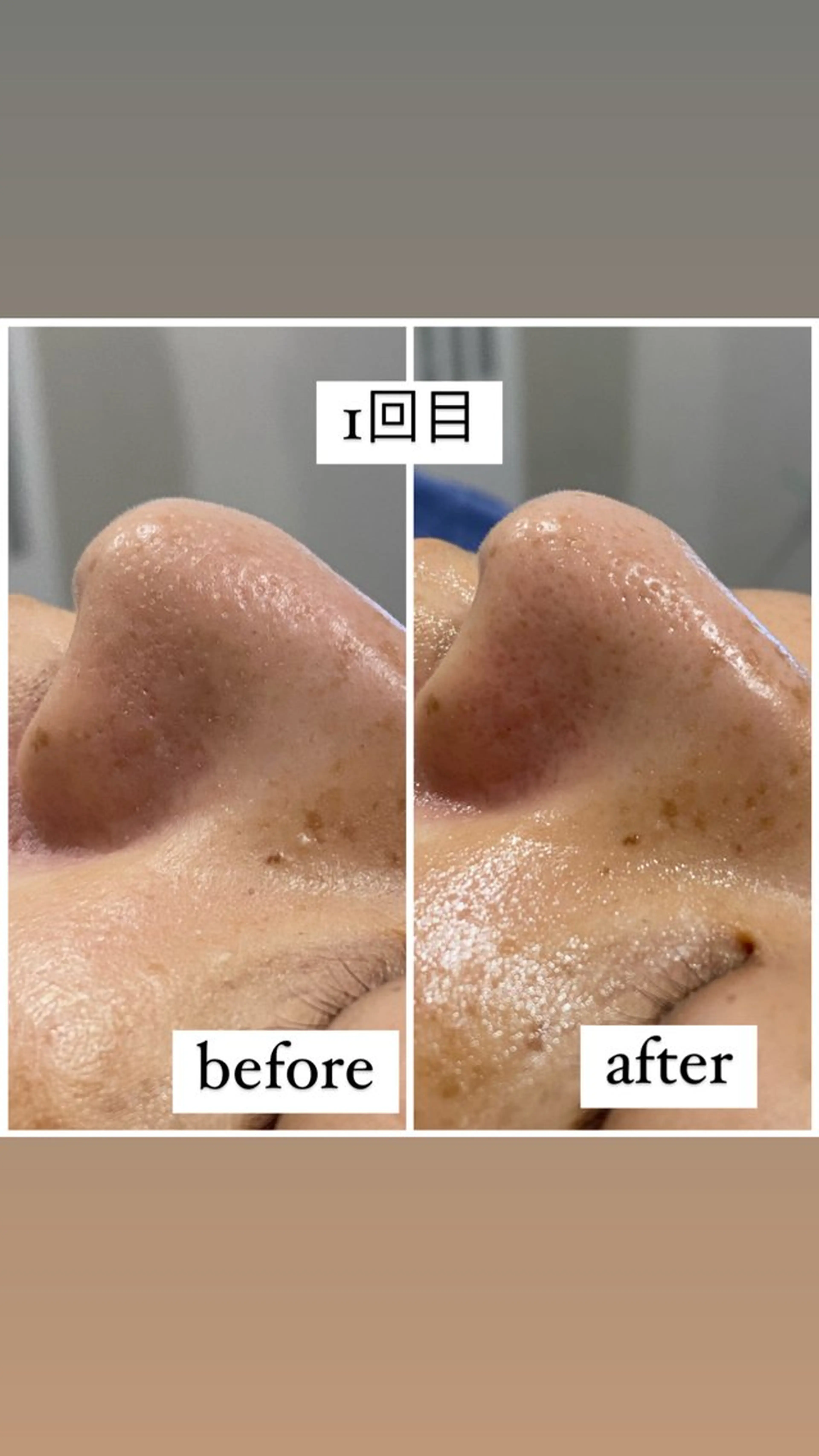 エステ アルカンジュ~archange~所属・痩身/毛穴洗浄/脱毛 アルカンジュのエステ・リラクイメージ