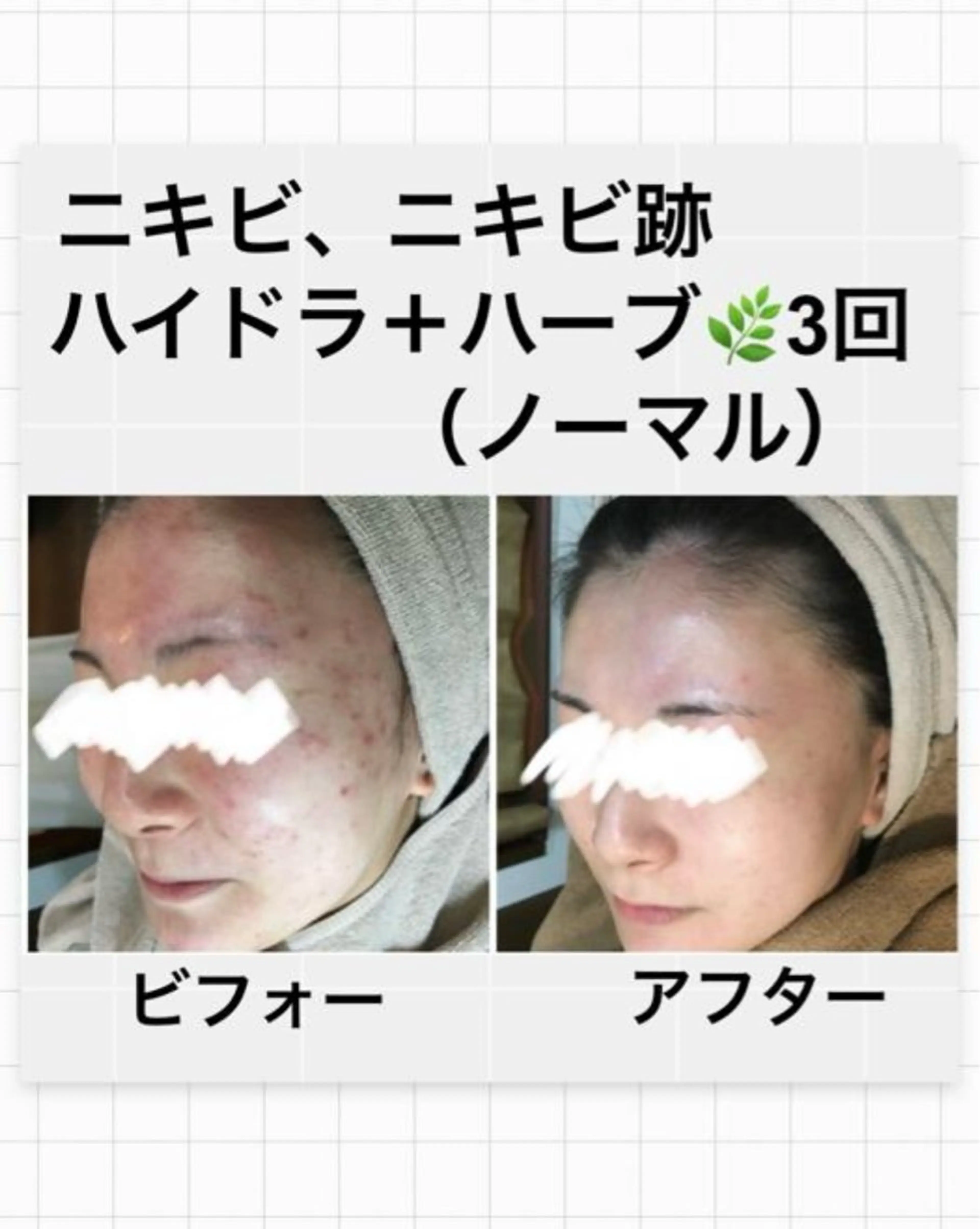ハーブピーリング専門 MOKAのエステ・リラクイメージ