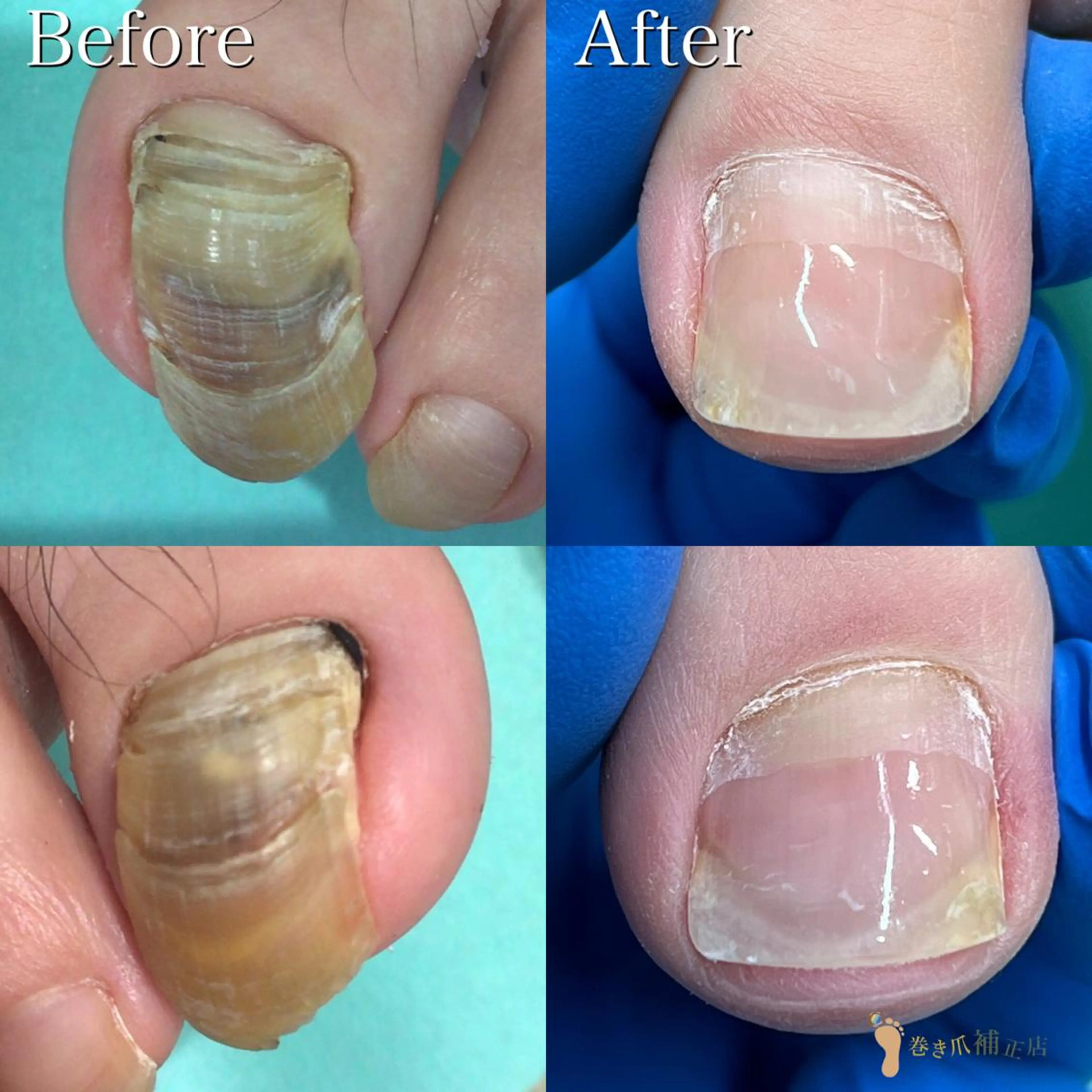 東京巻き爪 アカデミーのエステ・リラクイメージ