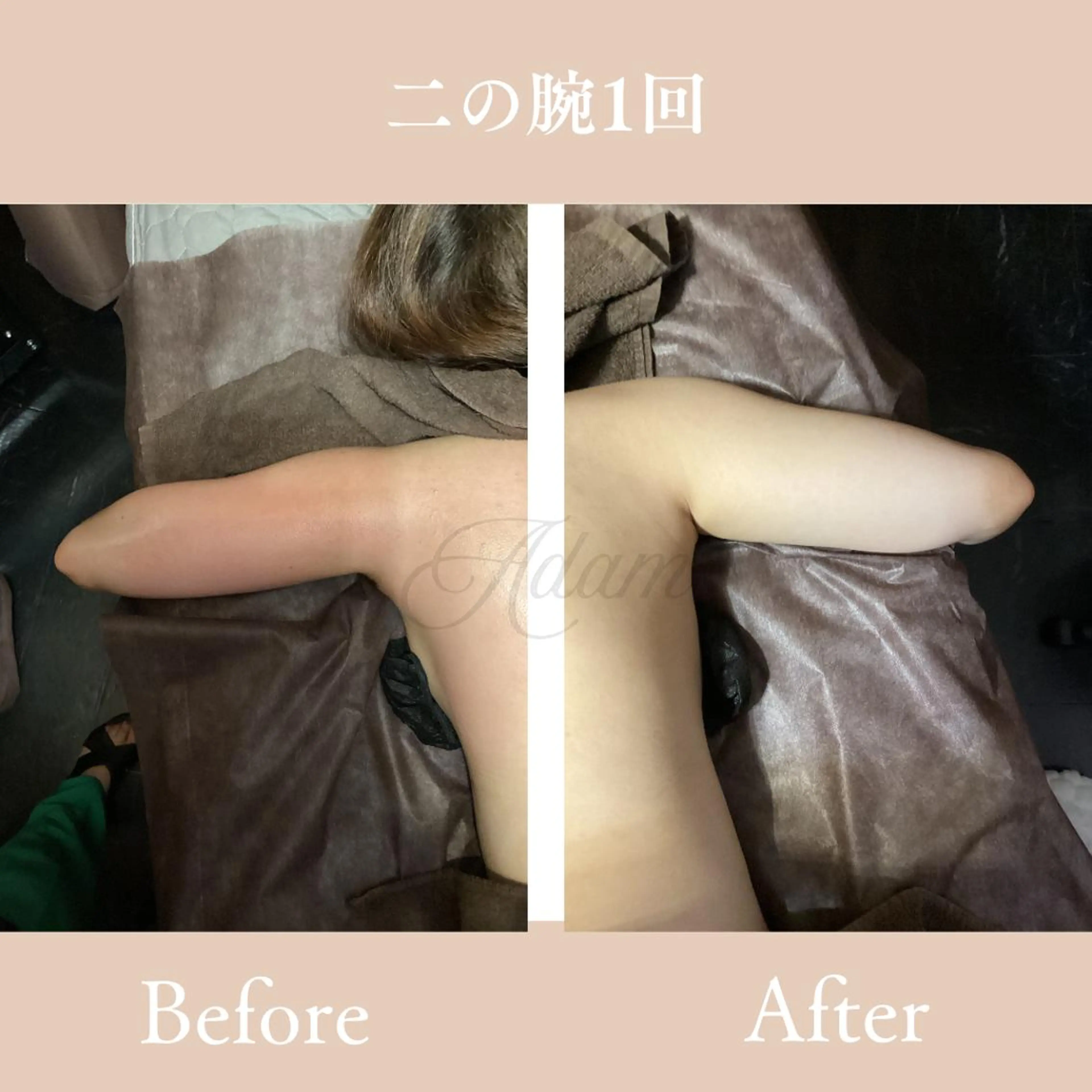 Adam salonのエステ・リラクイメージ