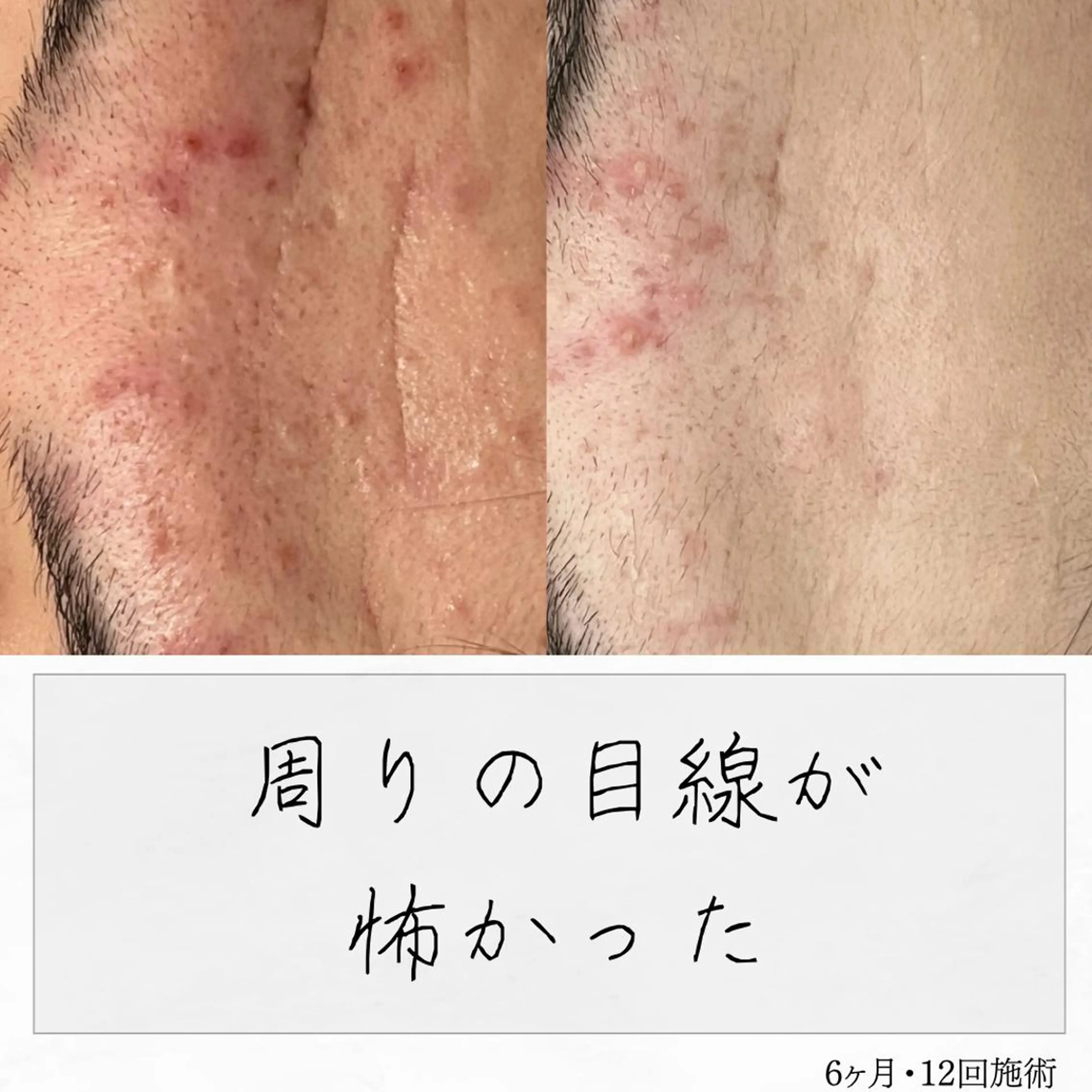 ニキビ経験者が施術 する専門サロン🌻のエステ・リラクイメージ