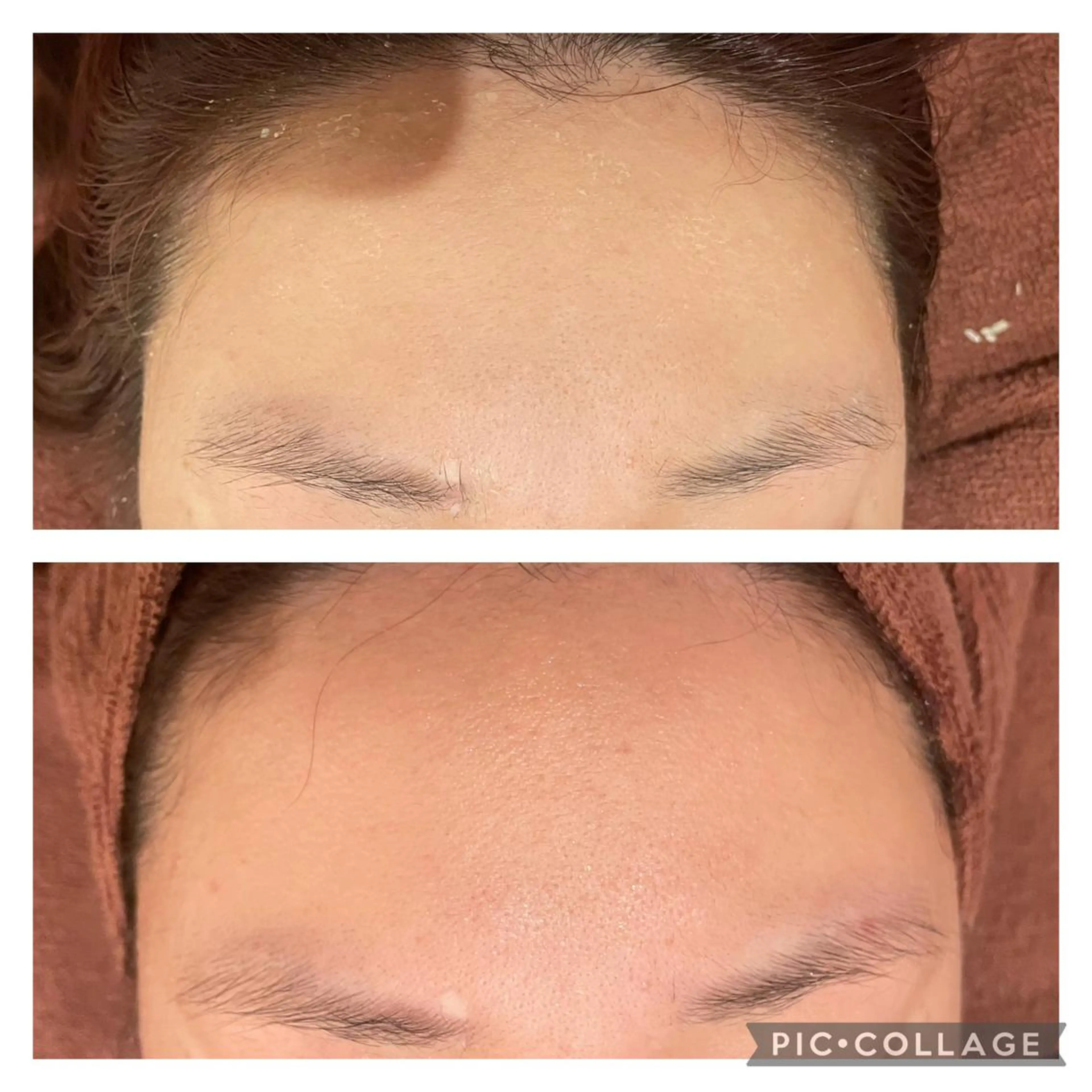 ロング カラー パーマ ヘアアレンジ メンズ キッズ ネイル マツエク・マツパ アイブロウ エステ リラク ニキビ特化型エステ 🍋最短で肌質改善のエステ・リラクイメージ