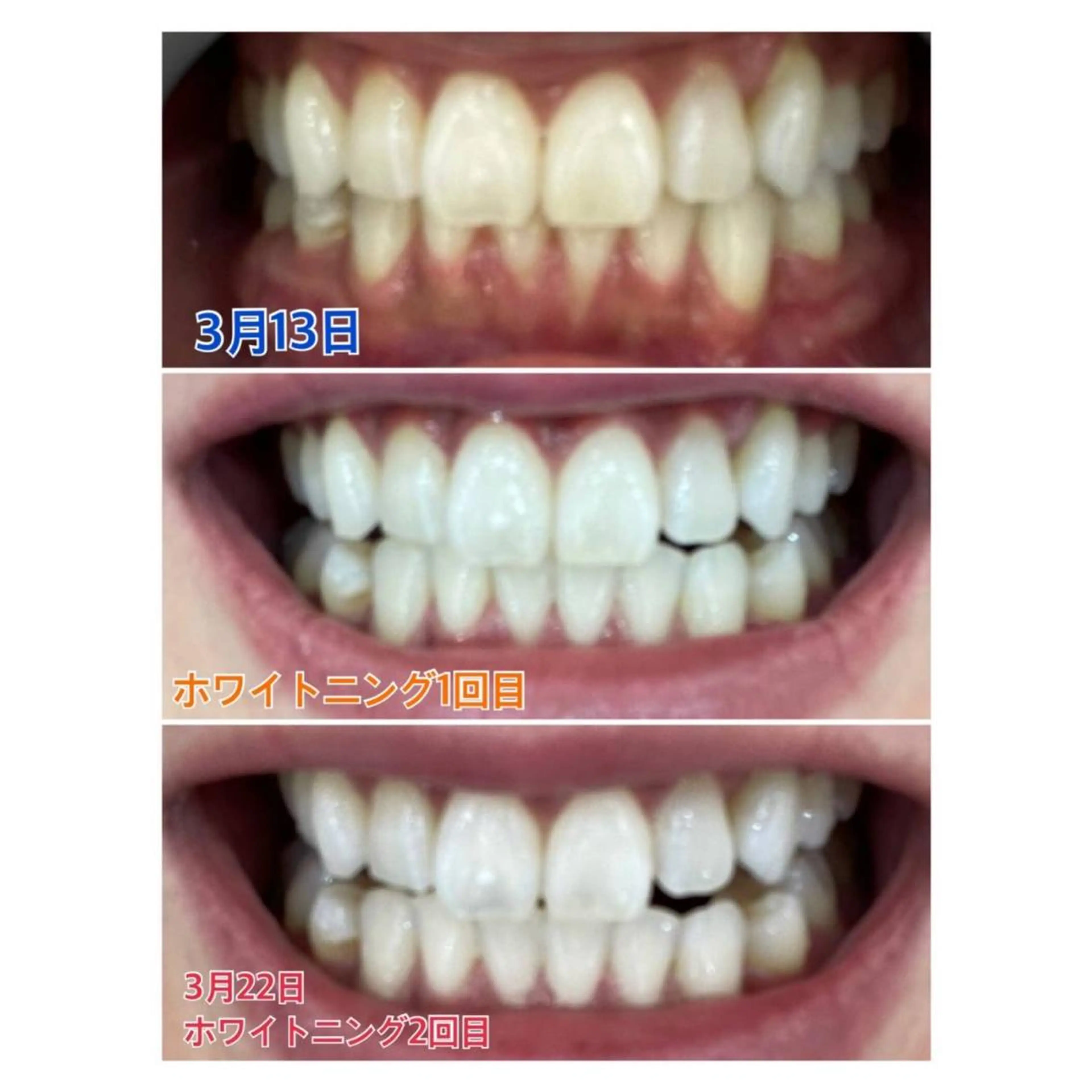 MBEAUTYSALON 千葉店・京成大久保所属・Melty 輝のその他イメージ